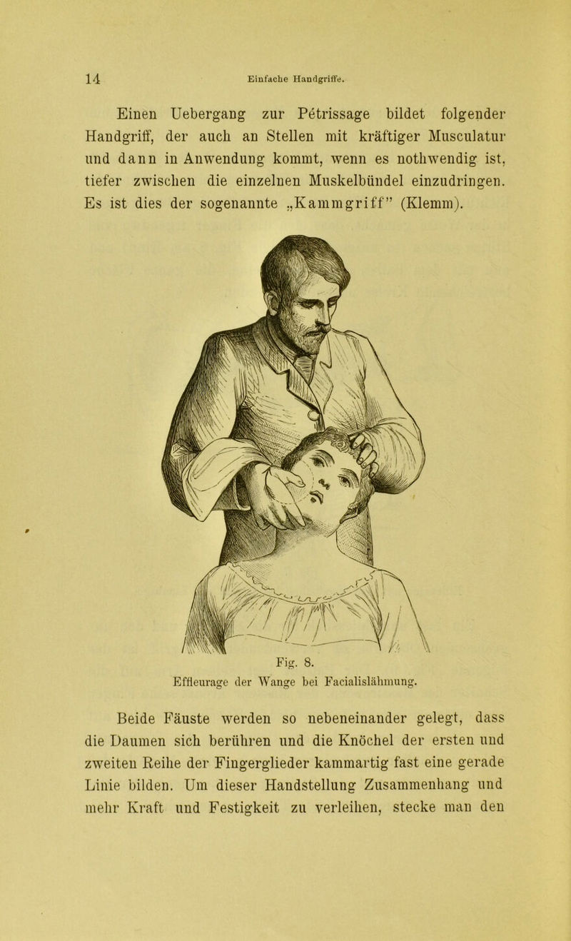 Einen Uebergang zur Petrissage bildet folgender Handgriff, der auch an Stellen mit kräftiger Musculatur und dann in Anwendung kommt, wenn es notkwendig ist, tiefer zwischen die einzelnen Muskelbündel einzudringen. Es ist dies der sogenannte „Kammgriff” (Klemm). Fig. 8. Effieurage der Wange bei Facialislähmung. Beide Fäuste werden so nebeneinander gelegt, dass die Daumen sich berühren und die Knöchel der ersten und zweiten Reihe der Fingerglieder kammartig fast eine gerade Linie bilden. Um dieser Handstellung Zusammenhang und mehr Kraft und Festigkeit zu verleihen, stecke man den