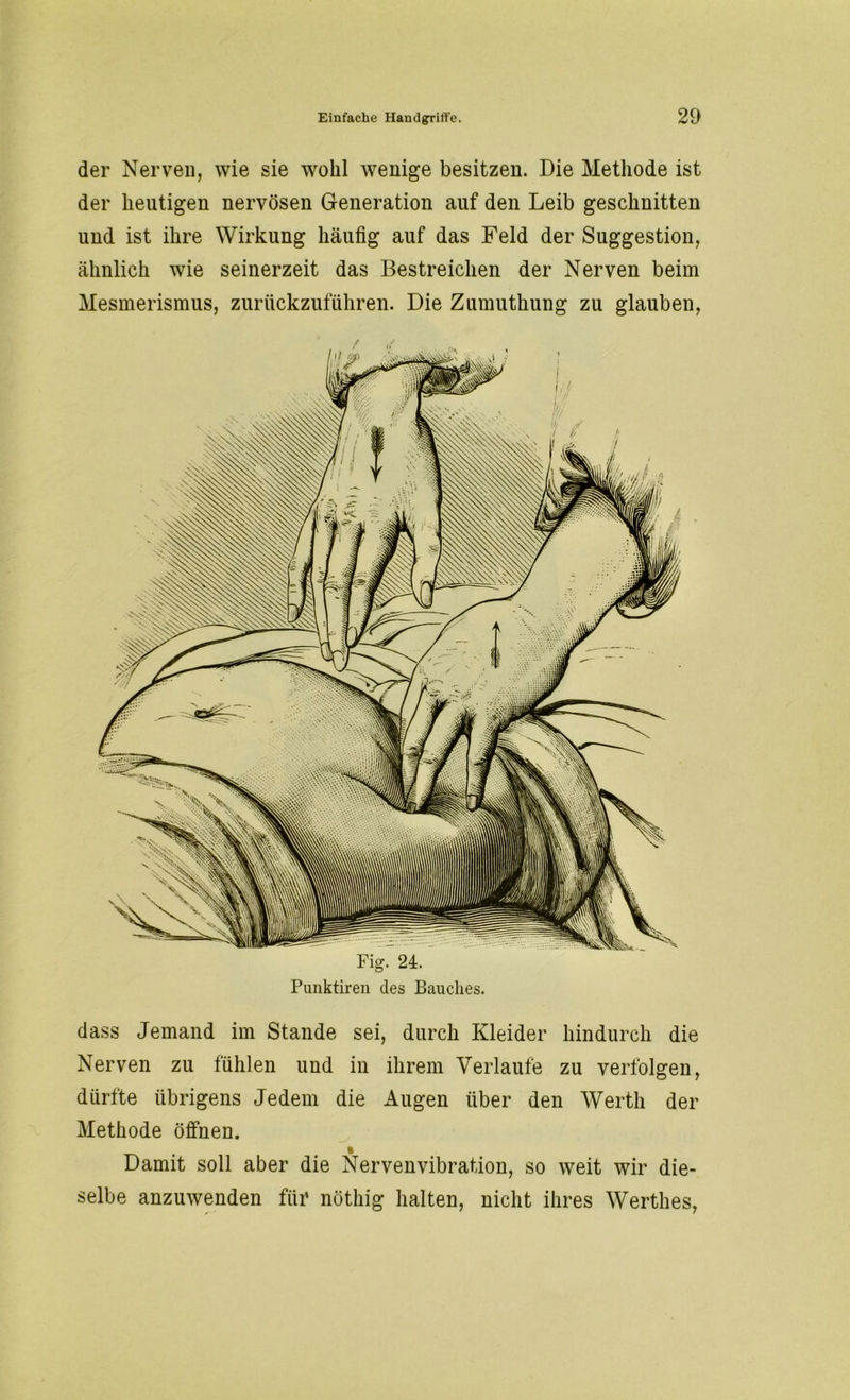 der Nerven, wie sie wohl wenige besitzen. Die Methode ist der heutigen nervösen Generation auf den Leib geschnitten und ist ihre Wirkung häufig auf das Feld der Suggestion, ähnlich wie seinerzeit das Bestreichen der Nerven beim Mesmerismus, zurückzuführen. Die Zumuthung zu glauben, Fig. 24. Punktiren des Bauches. dass Jemand im Stande sei, durch Kleider hindurch die Nerven zu fühlen und in ihrem Verlaufe zu verfolgen, dürfte übrigens Jedem die Augen über den Werth der Methode öffnen. Damit soll aber die Nervenvibration, so weit wir die- selbe anzuwenden für nöthig halten, nicht ihres Werthes,