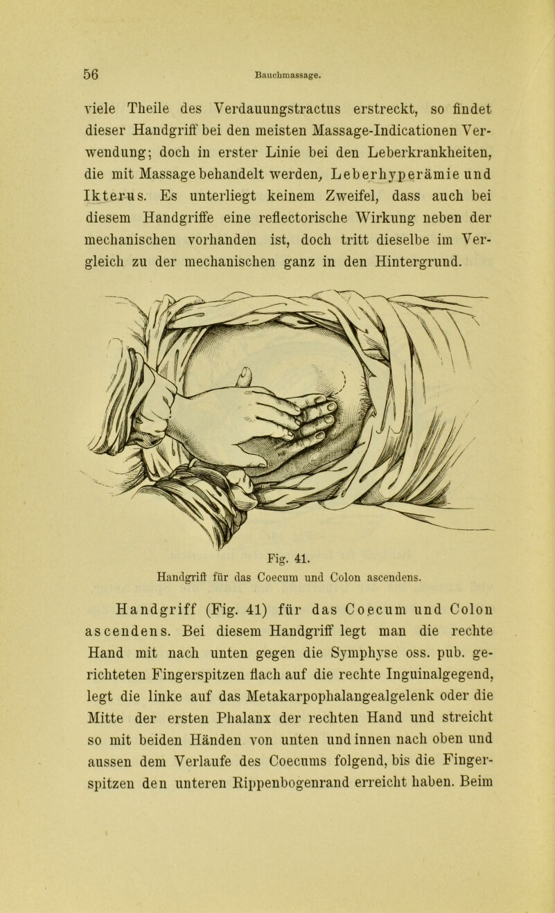 viele Theile des Verdauungstractus erstreckt, so findet dieser Handgriff bei den meisten Massage-Indicationen Ver- wendung; doch in erster Linie bei den Leberkrankheiten, die mit Massage behandelt werden, Leberhyperämie und Ikterus. Es unterliegt keinem Zweifel, dass auch bei diesem Handgriffe eine reflectorische Wirkung neben der mechanischen vorhanden ist, doch tritt dieselbe im Ver- gleich zu der mechanischen ganz in den Hintergrund. Fig. 41 Handgriff für das Coecum und Colon ascendens. Handgriff (Fig. 41) für das Coecum und Colon ascendens. Bei diesem Handgriff* legt man die rechte Hand mit nach unten gegen die Symphyse oss. pub. ge- richteten Fingerspitzen flach auf die rechte Inguinalgegend, legt die linke auf das Metakarpoplialangealgelenk oder die Mitte der ersten Phalanx der rechten Hand und streicht so mit beiden Händen von unten und innen nach oben und aussen dem Verlaufe des Coecums folgend, bis die Finger- spitzen den unteren Rippenbogenrand erreicht haben. Beim