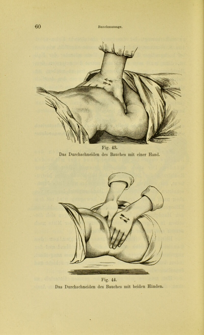 Fis;. 48. C1 Das Durchschneiden des Bauches mit einer Hand. Fig. 44. Das Durchschneiden des Bauches mit beiden Händen.