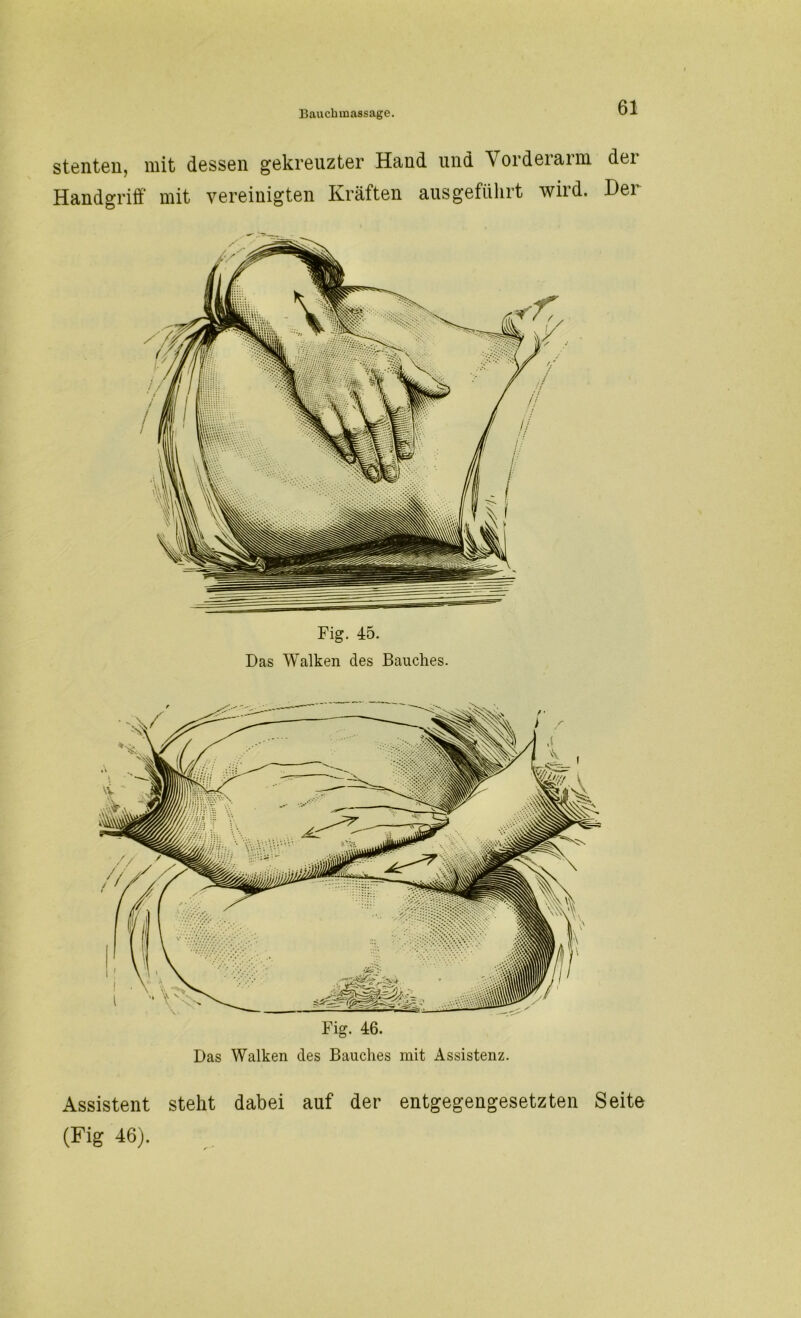 stenten, mit dessen gekreuzter Hand und Vorderarm der Handgriff mit vereinigten Kräften aus geführt wird. Her Fig. 45. Das Walken des Bauches. Fig. 46. Das Walken des Bauches mit Assistenz. Assistent steht dabei auf der entgegengesetzten Seite (Fig 46).