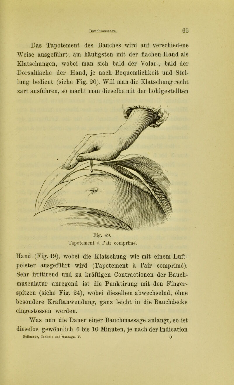 Das Tapotement des Bauches wird aut verschiedene Weise ausgeführt; am häufigsten mit der flachen Hand als Klatschungen, wobei man sich bald der Volar-, bald der Dorsalfläche der Hand, je nach Bequemlichkeit und Stel- lung bedient (siehe Fig. 20). Will man die Klatschung recht zart aiisführen, so macht man dieselbe mit der hohlgestellten Tapotement ä l’air comprime. Hand (Fig. 49), wobei die Klatschung wie mit einem Luft- polster ausgefiihrt wird (Tapotement ä Pair comprime). Sehr irritirend und zu kräftigen Contractionen der Baucli- musculatur anregend ist die Punktirung mit den Finger- spitzen (siehe Fig. 24), wobei dieselben abwechselnd, ohne besondere Kraftanwendung, ganz leicht in die Bauchdecke eingestossen werden. Was nun die Dauer einer Bauchmassage anlangt, so ist dieselbe gewöhnlich 6 bis 10 Minuten, je nach der Indication Reibniayr, Technik der Massage- V. 5