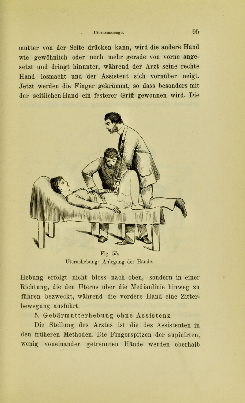 mutter von der Seite drücken kann, wird die andere Hand wie gewöhnlich oder noch mehr gerade von vorne ange- setzt und dringt hinunter, während der Arzt seine rechte Hand losmacht und der Assistent sich vornüber neigt. Jetzt werden die Finger gekrümmt, so dass besonders mit der seitlichen Hand ein festerer Griff gewonnen wird. Die Fig. 55. Uterushebung: Anlegung der Hände. Hebung erfolgt nicht bloss nach oben, sondern in einer Richtung, die den Uterus über die Medianlinie hinweg zu führen bezweckt, während die vordere Hand eine Zitter- bewegung ausführt. 5. Gebärmutterhebung ohne Assistenz. Die Stellung des Arztes ist die des Assistenten in den früheren Methoden. Die Fingerspitzen der supinirten, wenig voneinander getrennten Hände werden oberhalb