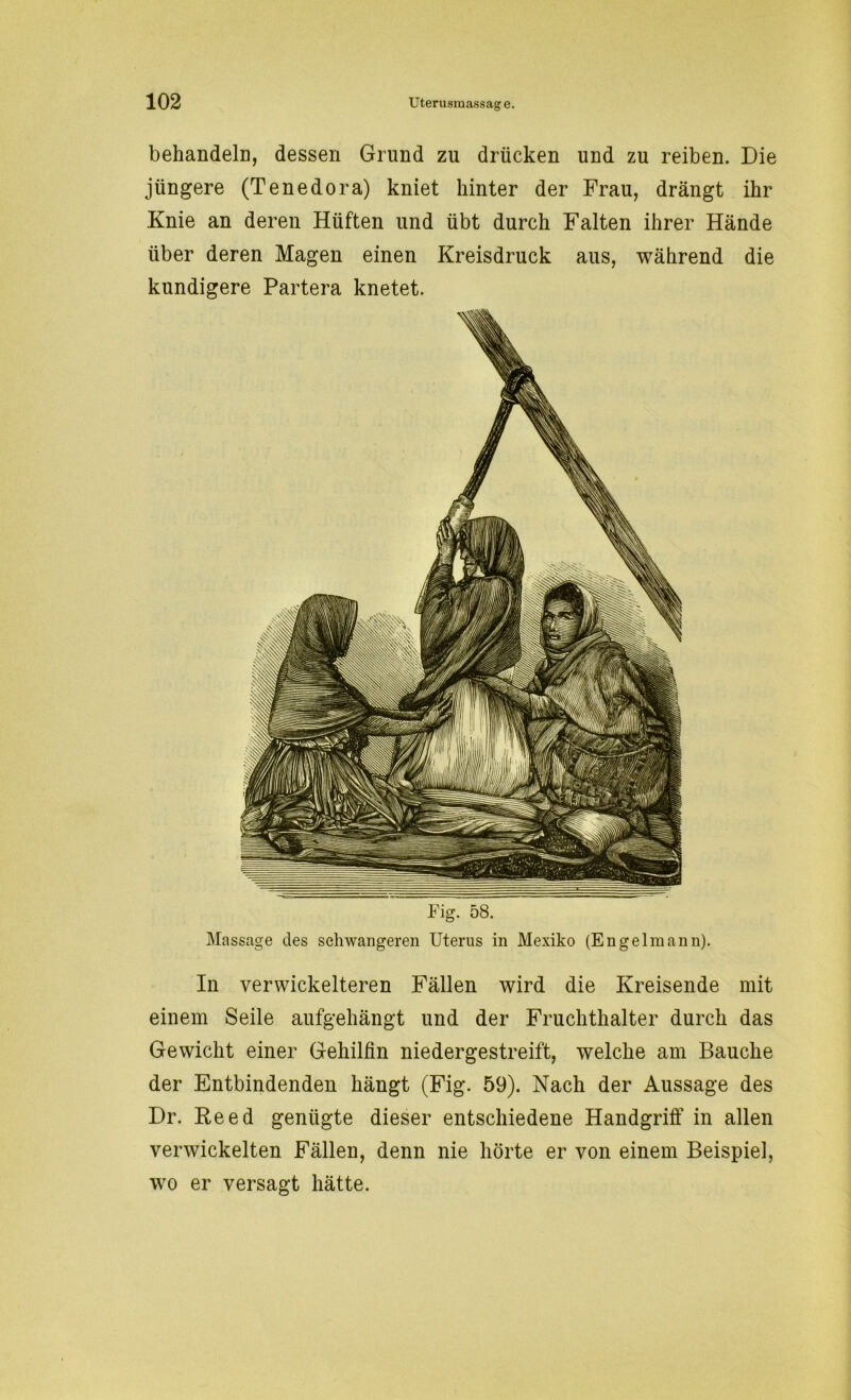 behandele, dessen Grund zu drücken und zu reiben. Die jüngere (Tenedora) kniet hinter der Frau, drängt ihr Knie an deren Hüften und übt durch Falten ihrer Hände über deren Magen einen Kreisdruck aus, während die kundigere Partera knetet. Fig. 58. Massage des schwangeren Uterus in Mexiko (Engelmann). In verwickelteren Fällen wird die Kreisende mit einem Seile aufgehängt und der Fruchthalter durch das Gewicht einer Gehilfin niedergestreift, welche am Bauche der Entbindenden hängt (Fig. 59). Nach der Aussage des Dr. Reed genügte dieser entschiedene Handgriff in allen verwickelten Fällen, denn nie hörte er von einem Beispiel, wo er versagt hätte.