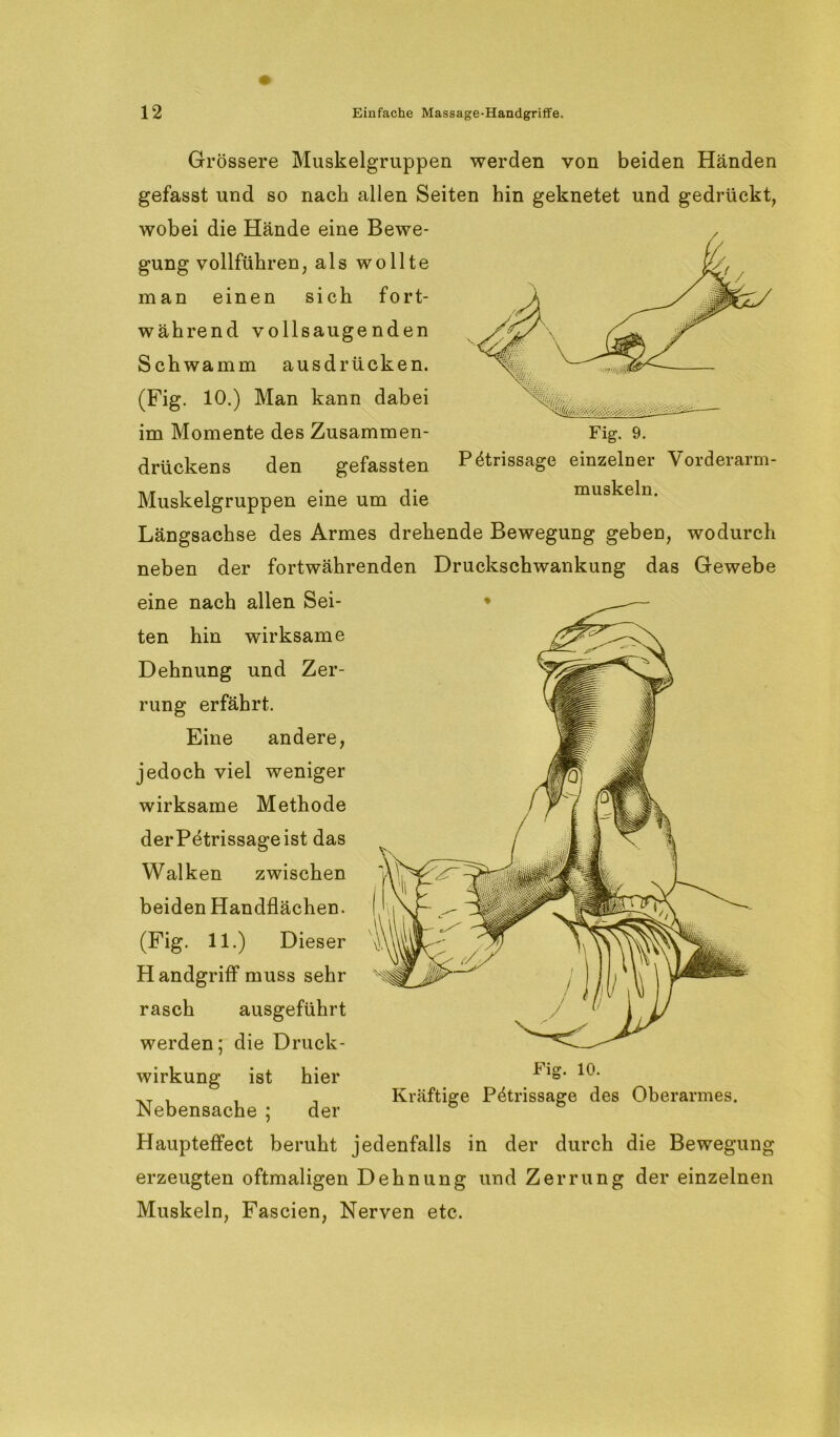 Fig. 9. P^trissage einzelner Vorderarm- muskeln. Grössere Muskelgruppen werden von beiden Händen gefasst und so nach allen Seiten hin geknetet und gedrückt, wobei die Hände eine Bewe- gung vollführen, als wollte man einen sich fort- während vollsaugenden Schwamm ausdrücken. (Fig. 10.) Man kann dabei im Momente des Zusammen- drückens den gefassten Muskelgruppen eine um die Längsachse des Armes drehende Bewegung geben, wodurch neben der fortwährenden Druckschwankung das Gewebe eine nach allen Sei- ten hin wirksame Dehnung und Zer- rung erfährt. Eine andere, jedoch viel weniger wirksame Methode derPetrissageist das Walken zwischen beiden Handflächen. (Fig. 11.) Dieser Handgriff muss sehr rasch ausgeführt werden; die Druck- wirkung ist hier Nebensache ; der Haupteffect beruht jedenfalls in der durch die Bewegung erzeugten oftmaligen Dehnung und Zerrung der einzelnen Muskeln, Fascien, Nerven etc. Fig. 10. Kräftige P4trissage des Oberarmes.