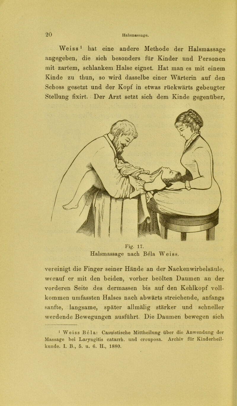 Weiss 1 hat eine andere Methode der Halsraassage angegeben, die sich besonders für Kinder und Personen mit zartem, schlankem Halse eignet. Hat man es mit einem Kinde zu thun, so wird dasselbe einer Wärterin auf den Schoss gesetzt und der Kopf in etwas rückwärts gebeugter Stellung lixirt. Der Arzt setzt sich dem Kinde gegenüber, Fig. 17. Halsmassage nach B41a Weiss. vereinigt die Finger seiner Hände an der Nackenwirbelsäule, worauf er mit den beiden, vorher beölten Daumen an der vorderen Seite des dermassen bis auf den Kehlkopf voll- kommen umfassten Halses nach abwärts streichende, anfangs sanfte, langsame, später allmälig stärker und schneller werdende Bewegungen ausführt. Die Daumen bewegen sich 1 Weiss Bela: Casuistische Mittheilung über die Anwendung der Massage bei Laryngitis catarrh. und crouposa. Archiv für Kinderheil- kunde. I. B., 5. u. 6. H., 1880.
