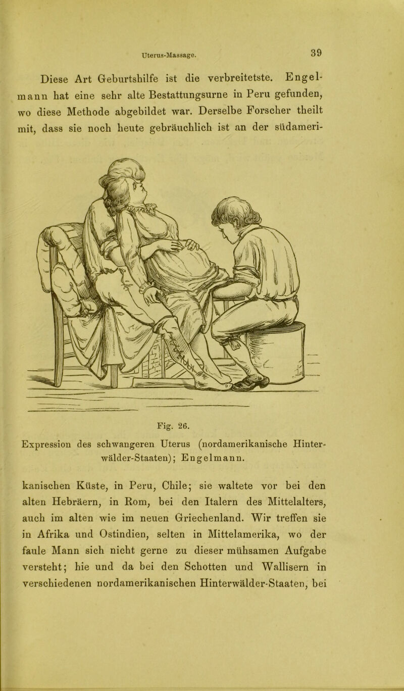 Diese Art Geburtshilfe ist die verbreitetste. Engel- mann hat eine sehr alte Bestattungsurne in Peru gefunden, wo diese Methode abgebildet war. Derselbe Forscher theilt mit, dass sie noch heute gebräuchlich ist an der südameri- Fig. 26. Expression des schwangeren Uterus (nordamerikanische Hinter- wälder-Staaten); Engelmann. Panischen Küste, in Peru, Chile; sie waltete vor bei den alten Hebräern, in Rom, bei den Italern des Mittelalters, auch im alten wie im neuen Griechenland. Wir treffen sie in Afrika und Ostindien, selten in Mittelamerika, wo der faule Mann sich nicht gerne zu dieser mühsamen Aufgabe versteht; hie und da bei den Schotten und Wallisern in verschiedenen nordamerikanischen Hinterwälder-Staaten, bei
