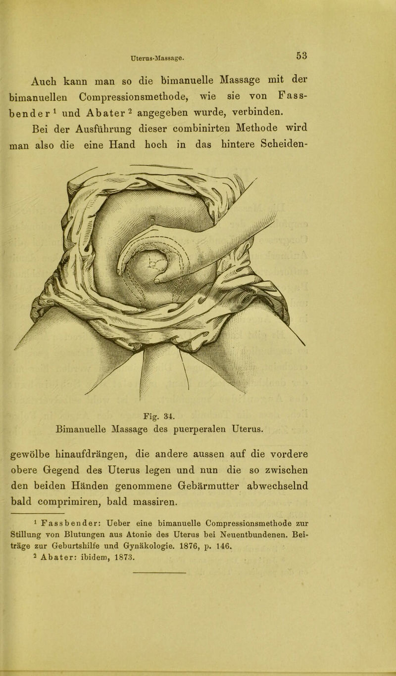 Auch kann man so die bimanuelle Massage mit der bimanuellen Compressionsmetkode, wie sie von Fass- bender1 und Abater2 angegeben wurde, verbinden. Bei der Ausführung dieser combinirten Methode wird man also die eine Hand hoch in das hintere Scheiden- Fig. 34. Bimanuelle Massage des puerperalen Uterus. gewölbe hinaufdrängen, die andere aussen auf die vordere obere Gegend des Uterus legen und nun die so zwischen den beiden Händen genommene Gebärmutter abwechselnd bald comprimiren, bald massiren. 1 Fassbender: Ueber eine bimanuelle Compressionsmethode zur Stillung von Blutungen aus Atonie des Uterus bei Neuentbundenen. Bei- träge zur Geburtshilfe und Gynäkologie. 1876, p. 146. 2 Abater: ibidem, 1873.