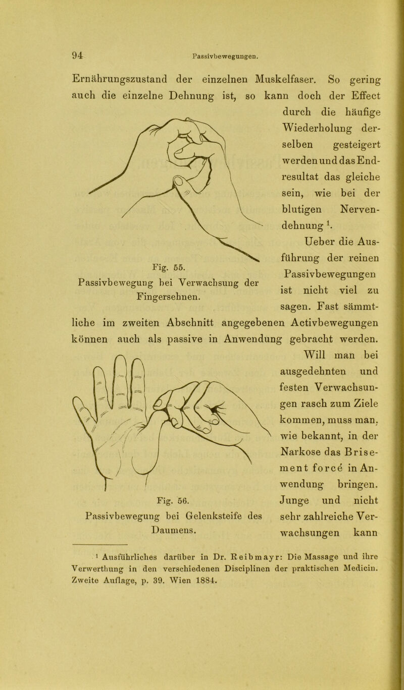 Ernährungszustand der einzelnen Muskelfaser. So gering auch die einzelne Dehnung ist, so kann doch der Effect durch die häufige Wiederholung der- selben gesteigert werden und das End- resultat das gleiche sein, wie bei der blutigen Nerven- dehnung h Ueber die Aus- führung der reinen Passivbewegungen ist nicht viel zu sagen. Fast sämmt- liche im zweiten Abschnitt angegebenen Activbewegungen können auch als passive in Anwendung gebracht wrerden. Will man bei ausgedehnten und festen Verwachsun- gen rasch zum Ziele kommen, muss man. wie bekannt, in der Narkose das Brise- ment force in An- wendung bringen. Junge und nicht sehr zahlreiche Ver- Fig. 55. Passivbewegung bei Verwachsung der Fingersehnen. Fig. 56. Passivbewegung bei Gelenksteife des Daumens. wachsungen kann 1 Ausführliches darüber in Dr. Reibmayr: Die Massage und ihre Verwerthung in den verschiedenen Disciplinen der praktischen Medicin. Zweite Auflage, p. 39. Wien 1884.