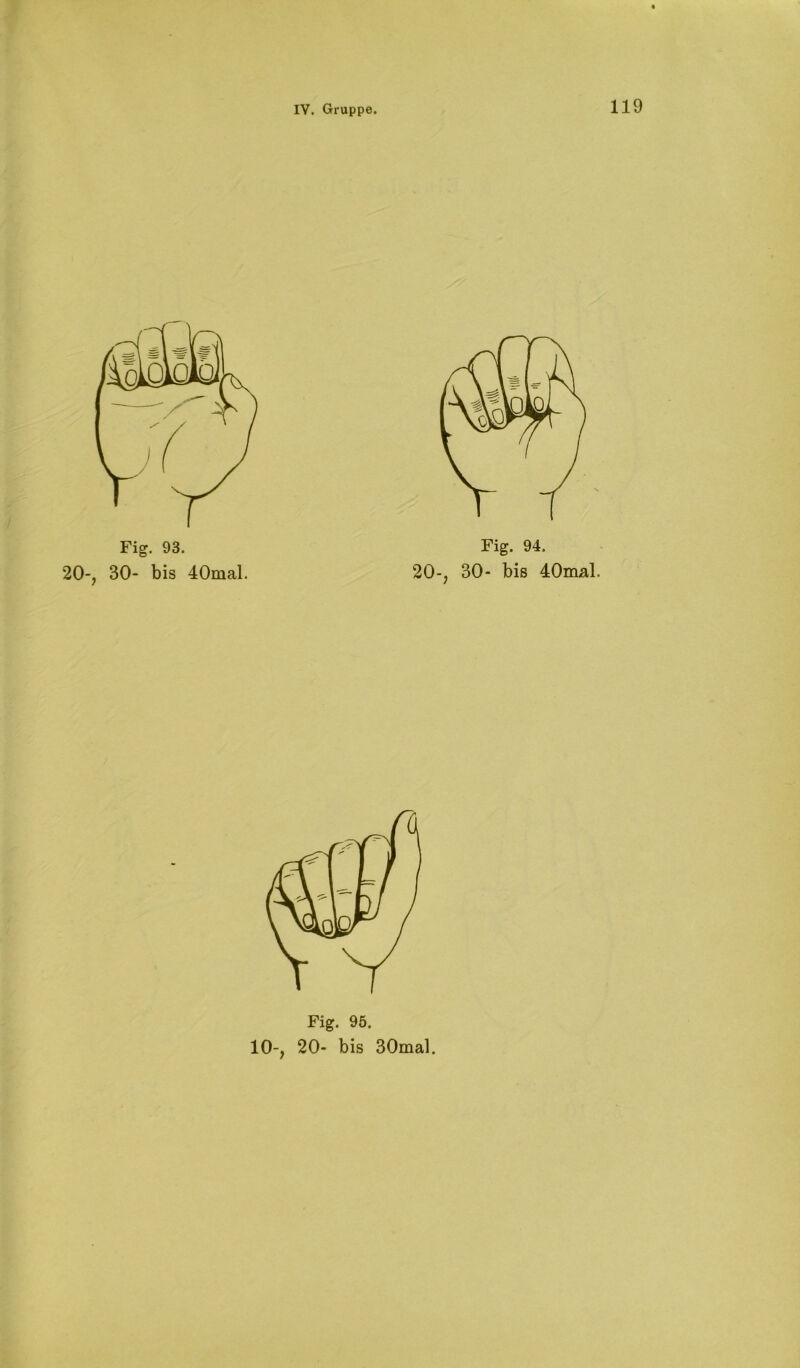 Fig. 93. 20-, 30- bis 40mal. Fig. 94. 20-, 30- bis 40mal. Fig. 95.