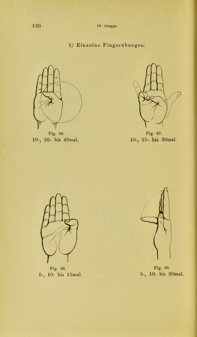 b) Einzelne Fingerübungen. Fig. 96. 10-, 20- bis 40mal. Fig. 97. 10-, 15- bis 20mal. Fig. 98. Fig. 99.