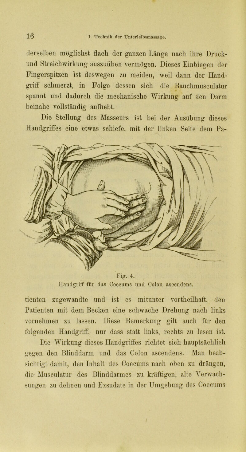 derselben möglichst flach der ganzen Länge nach ihre Druck- und Streichwirkung auszuüben vermögen. Dieses Einbiegen der Fingerspitzen ist deswegen zu meiden, weil dann der Hand- griff schmerzt, in Folge dessen sich die Bauchmusculatur . * spannt und dadurch die mechanische Wirkung auf den Darm beinahe vollständig aufhebt. Die Stellung des Masseurs ist bei der Ausübung dieses Handgriffes eine etwas schiefe, mit der linken Seite dem Pa- Fig. 4. Handgriff für das Coeeums und Colon ascendens. tienten zugewandte und ist es mitunter vortheilhaft, den Patienten mit dem Becken eine schwache Drehung nach links vornehmen zu lassen. Diese Bemerkung gilt auch für den folgenden Handgriff, nur dass statt links, rechts zu lesen ist. Die Wirkung dieses Handgriffes richtet sich hauptsächlich gegen den Blinddarm und das Colon ascendens. Man beab- sichtigt damit, den Inhalt des Coeeums nach oben zu drängen, die Musculatur des Blinddarmes zu kräftigen, alte Verwach- sungen zu dehnen und Exsudate in der Umgebung des Coeeums