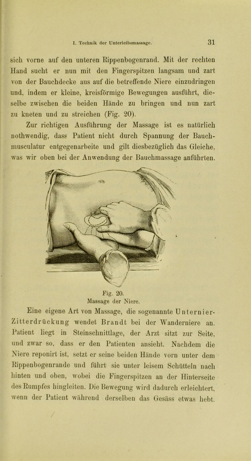 sich vorne auf den unteren Rippenbogenrand. Mit der rechten Hand sucht er nun mit den Fingerspitzen langsam und zart von der ßauchdecke aus auf die betreffende Niere einzudringen und, indem er kleine, kreisförmige Bewegungen ausführt, die- selbe zwischen die beiden Hände zu bringen und nun zart zu kneten und zu streichen (Fig. 20). Zur richtigen Ausführung der Massage ist es natürlich nothwendig, dass Patient nicht durch Spannung der Bauch- musculatur entgegenarbeite und gilt diesbezüglich das Gleiche, was wir oben bei der Anwendung der Bauchmassage anführten. Eine eigene Art von Massage, die sogenannte Unternier- Zitterdrückung wendet Brandt bei der Wanderniere an. Patient liegt in Steinschnittlage, der Arzt sitzt zur Seite, und zwar so, dass er den Patienten ansieht. Nachdem die Niere reponirt ist, setzt er seine beiden Hände vorn unter dem Rippenbogenrande und führt sie unter leisem Schütteln nach hinten und oben, wobei die Fingerspitzen an der Hinterseite des Rumpfes hingleiten. Die Bewegung wird dadurch erleichtert, wenn der Patient während derselben das Gesäss etwas hebt.