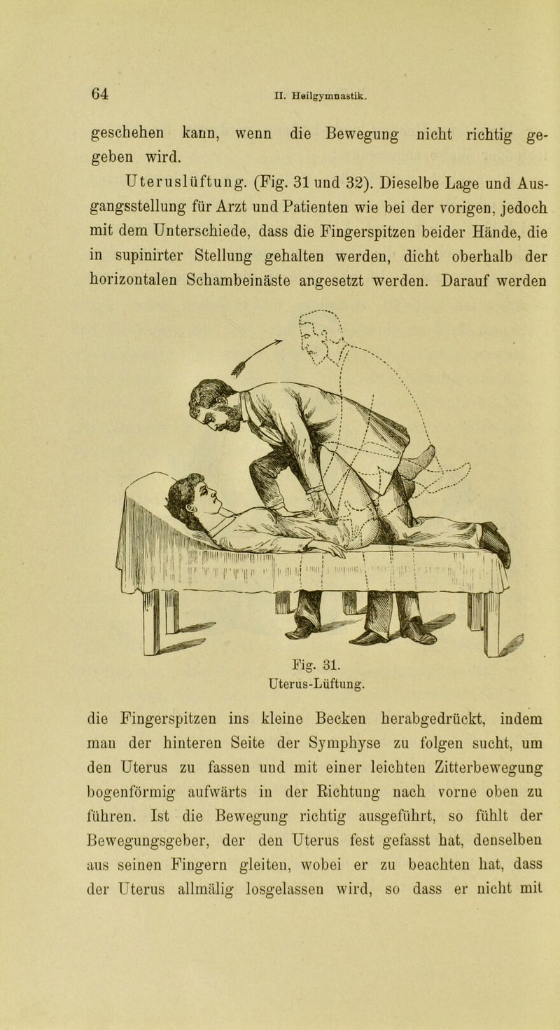 geschehen kann, wenn die Bewegung nicht richtig ge- geben wird. Uteruslüftung. (Fig. 31 und 32). Dieselbe Lage und Aus- gangsstellung für Arzt und Patienten wie bei der vorigen, jedoch mit dem Unterschiede, dass die Fingerspitzen beider Hände, die in supinirter Stellung gehalten werden, dicht oberhalb der horizontalen Schambeinäste angesetzt werden. Darauf werden Fig. 31. Uterus-Lüftung. die Fingerspitzen ins kleine Becken herabgedrückt, indem mau der hinteren Seite der Symphyse zu folgen sucht, um den Uterus zu fassen und mit einer leichten Zitterbewegung bogenförmig aufwärts in der Richtung nach vorne oben zu führen. Ist die Bewegung richtig ausgeführt, so fühlt der Bewegungsgeber, der den Uterus fest gefasst hat, denselben aus seinen Fingern gleiten, wobei er zu beachten hat, dass der Uterus allmälig losgelassen wird, so dass er nicht mit