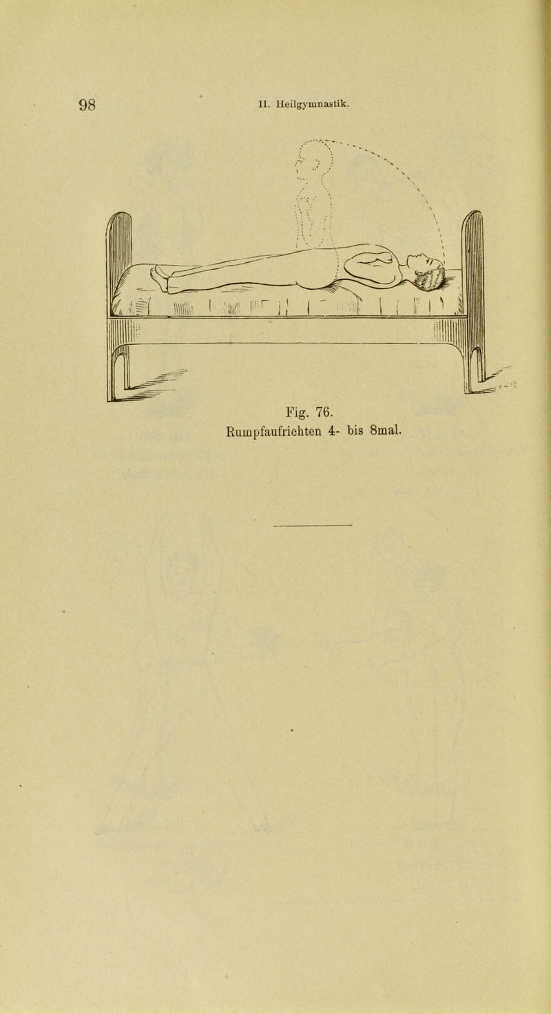 1 Fig. 76. Rumpfaufrieliten 4- bis 8mal.