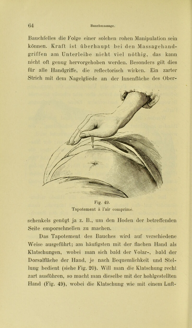 Bauchfelles die Folge einer solchen rohen Manipulation sein können. Kraft ist überhaupt hei den Massagehand- griffen am Unterleibe nicht viel nöthig, das kann nicht oft genug hervorgehoben werden. Besonders gilt dies für alle Handgriffe, die reflectorisch wirken. Ein zarter Strich mit dem Nagelgliede an der Innenfläche des Ober- Fig. 49. Tapotement ä Fair comprime. Schenkels genügt ja z. B., um den Hoden der betreffenden Seite emporschnellen zu machen. Das Tapotement des Bauches wird auf verschiedene Weise ausgeführt; am häufigsten mit der flachen Hand als Klatschungen, wobei man sich bald der Volar-, bald der Dorsalfläche der Hand, je nach Bequemlichkeit und Stel- lung bedient (siehe Fig. 20). Will man die Klatschung recht zart ausführen, so macht man dieselbe mit der hohlgestellten Hand (Fig. 49), wobei die Klatschung wie mit einem Luft-