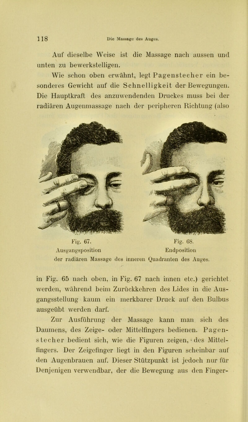 Auf dieselbe Weise ist die Massage nach aussen und unten zu bewerkstelligen. Wie schon oben erwähnt, legt Pagenstecher ein be- sonderes Gewicht auf die Schnelligkeit der Bewegungen. Die Hauptkraft des anzuwendenden Druckes muss bei der radiären Augenmassage nach der peripheren Richtung (also Fig. 67. Fig. 68. Ausgangsposition Endposition der radiären Massage des inneren Quadranten des Auges. in Fig. 65 nach oben, in Fig. 67 nach innen etc.) gerichtet werden, während beim Zurückkehren des Lides in die Aus- gangsstellung kaum ein merkbarer Druck auf den Bulbus ausgeübt werden darf. Zur Ausführung der Massage kann man sich des Daumens, des Zeige- oder Mittelfingers bedienen. Pagen- stecher bedient sich, wie die Figuren zeigen, * des Mittel- fingers. Der Zeigefinger liegt in den Figuren scheinbar auf den Augenbrauen auf. Dieser Stützpunkt ist jedoch nur für Denjenigen verwendbar, der die Bewegung aus den Finger-