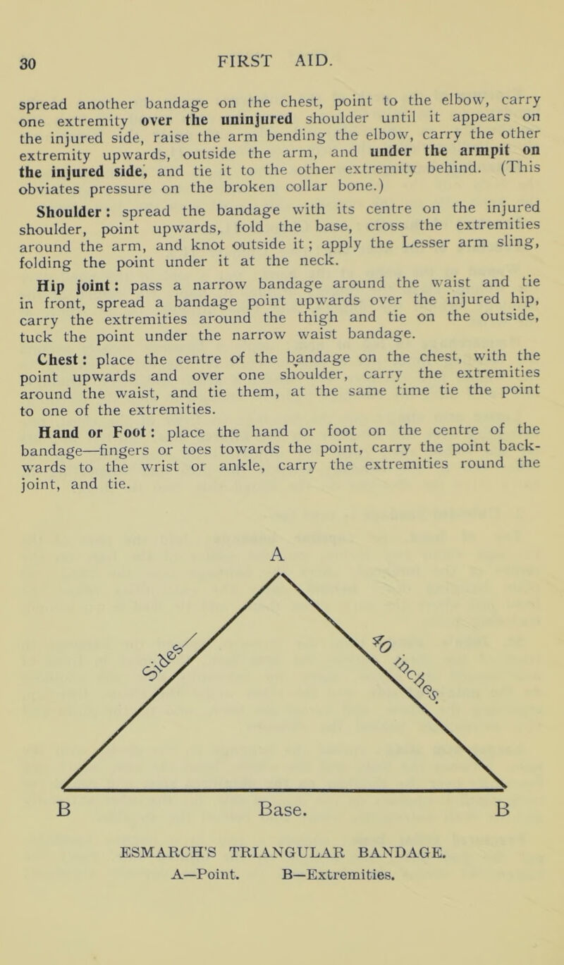 spread another bandage on the chest, point to the elbow, cariy one extremity over the uninjured shoulder until it appears on the injured side, raise the arm bending the elbow, carry the other extremity upwards, outside the arm, and under the armpit on the injured side, and tie it to the other extremity behind. (This obviates pressure on the broken collar bone.) Shoulder: spread the bandage with its centre on the injured shoulder, point upwards, fold the base, cross the extremities around the arm, and knot outside it; apply the Lesser arm sling, folding the point under it at the neck. Hip joint: pass a narrow bandage around the waist and tie in front, spread a bandage point upwards over the injured hip, carry the extremities around the thigh and tie on the outside, tuck the point under the narrow waist bandage. Chest: place the centre of the bandage on the chest, with the point upwards and over one shoulder, carry the extremities around the waist, and tie them, at the same time tie the point to one of the extremities. Hand or Foot: place the hand or foot on the centre of the bandage—fingers or toes towards the point, carry the point back- wards to the wrist or ankle, carry the extremities round the joint, and tie. A ESMARCH'S TRIANGULAR BANDAGE. A—Point. B—Extremities.