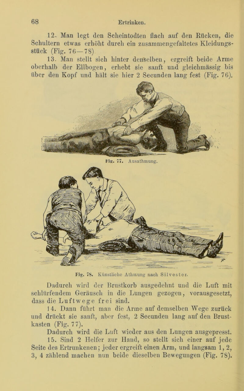 12. Man legt den Scheintodten flach auf den Rücken, die Schultern etwas erhöht durch ein zusammengefaltetes Kleidungs- stück (Fig. 76—78) 13. Man stellt sich hinter denselben, ergreift beide Arme oberhalb der Ellbogen, erhebt sie sanft und gleichmässig bis über den Kopf und hält sie liier 2 Secunden lang fest (Fig. 76). Fig. 77. Ausathmung. Fig. 78. Künstliche Athmung nach Silvester. Dadurch wird der Brustkorb ausgedehnt und die Luft mit schlürfendem Geräusch in die Lungen gezogen, vorausgesetzt, dass die Luftwege frei sind. 14. Dann führt man die Arme auf demselben Wege zurück und drückt sie sanft, aber fest, 2 Secunden lang auf den Brust- kasten (Fig. 7 7). Dadurch wird die Luft wieder aus den Lungen ausgepresst. 15. Sind 2 Helfer zur Hand, so stellt sich einer auf jede Seite des Ertrunkenen; jeder ergreift einen Arm, und langsam 1, 2, 3, 4 zählend machen nun beide dieselben Bewegungen (Fig. 78).