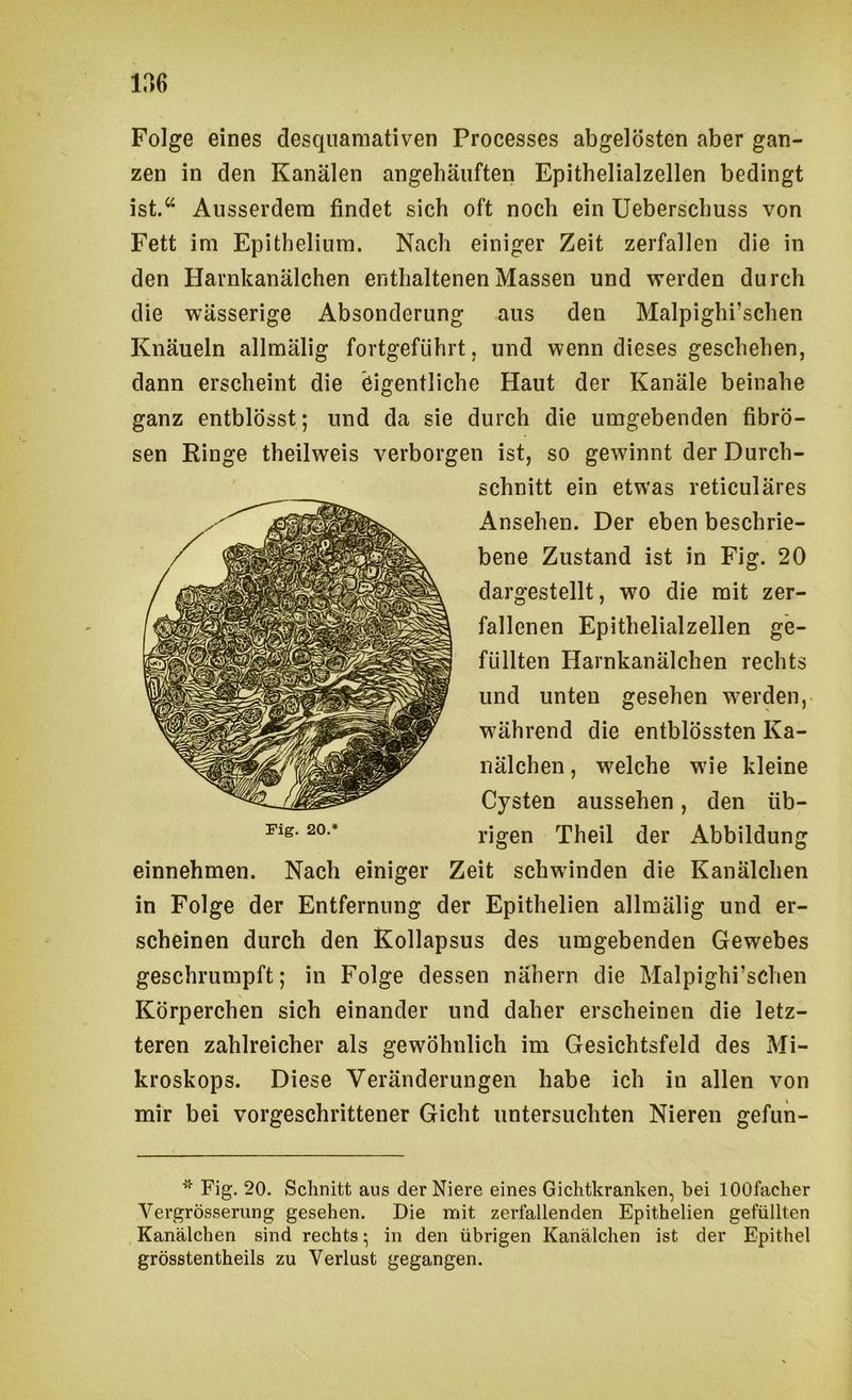 Folge eines desquamativen Processes abgelösten aber gan- zen in den Kanälen angebäuften Epithelialzellen bedingt ist.“ Ausserdem findet sich oft noch ein Ueberschuss von Fett im Epithelinm. Nach einiger Zeit zerfallen die in den Harnkanälchen enthaltenen Massen und werden durch die wässerige Absonderung aus den Malpighi’schen Knäueln allmälig fortgeführt, und wenn dieses geschehen, dann erscheint die eigentliche Haut der Kanäle beinahe ganz entblösst; und da sie durch die umgebenden fibrö- sen Ringe theilweis verborgen ist, so gewinnt der Durch- schnitt ein etwas reticuläres Ansehen. Der eben beschrie- bene Zustand ist in Fig. 20 dargestellt, wo die mit zer- fallenen Epithelialzellen ge- füllten Harnkanälchen rechts und unten gesehen w^erden, w^ährend die entblössten Ka- nälchen , welche wie kleine Cysten aussehen, den üb- rigen Theil der Abbildung einnehmen. Nach einiger Zeit schwinden die Kanälchen in Folge der Entfernung der Epithelien allmälig und er- scheinen durch den Kollapsus des umgebenden Gewebes geschrumpft; in Folge dessen nähern die Malpighi’schen Körperchen sich einander und daher erscheinen die letz- teren zahlreicher als gewöhnlich im Gesichtsfeld des Mi- kroskops. Diese Veränderungen habe ich in allen von mir bei vorgeschrittener Gicht untersuchten Nieren gefun- Fig. 20. Schnitt aus der Niere eines Gichtkranken, bei lOOfacher Vergrösserung gesehen. Die mit zerfallenden Epithelien gefüllten Kanälchen sind rechts • in den übrigen Kanälchen ist der Epithel grösstentheils zu Verlust gegangen.