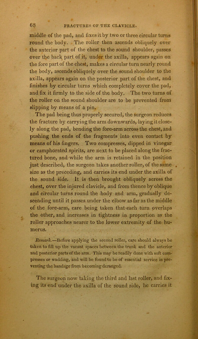 middle of the pad, and fixes it by two or three circular turns round the body. The roller then ascends obliquely over the anterior part of the chest to the sound shoulder, passes over the back part of it, under the axilla, appears again on the fore part of the chest, makes a circular turn nearly round the body, ascends obliquely over the sound shoulder to the axilla, appears again on the posterior part of the chest, and finishes by circular turns which completely cover the pad, and fix it firmly to the side of the body. The two turns of the roller on the sound shoulder are to be prevented from slipping by means of a pin. The pad being thus properly secured, the surgeon reduces the fracture by carrying the arm downwards, laying it close- ly along the pad, bending the fore-arm across the chest, and pushing the ends of the fragments into even contact by means of his fingers. Two compresses, dipped in vinegar or camphorated spirits, are next to be placed along the frac- tured bone, and while the arm is retained in the position just described, the surgeon takes another roller, of the same . size as the preceding, and carries its end under the axilla of the sound side. It is then brought obliquely across the chest, over the injured clavicle, and from thence by oblique and circular turns round the body and arm, gradually de- scending until it passes under the elbow as far as the middle of the fore-arm, care being taken that each turn overlaps the other, and increases in tightness in proportion as the roller approaches nearer to the lower extremity of the hu- merus. * • » > i 1 * » Remark.—Before applying the second roller, care should always be taken to fill up the vacant spaces between the trunk and the anterior and posterior parts of the arm. This may be readily done with soft com- presses or wadding, and will be found to be of essential service in pre- venting the bandage from becoming deranged. The surgeon now taking the third and last roller, and fix- ing its end under the axilla of the sound side, he carries it