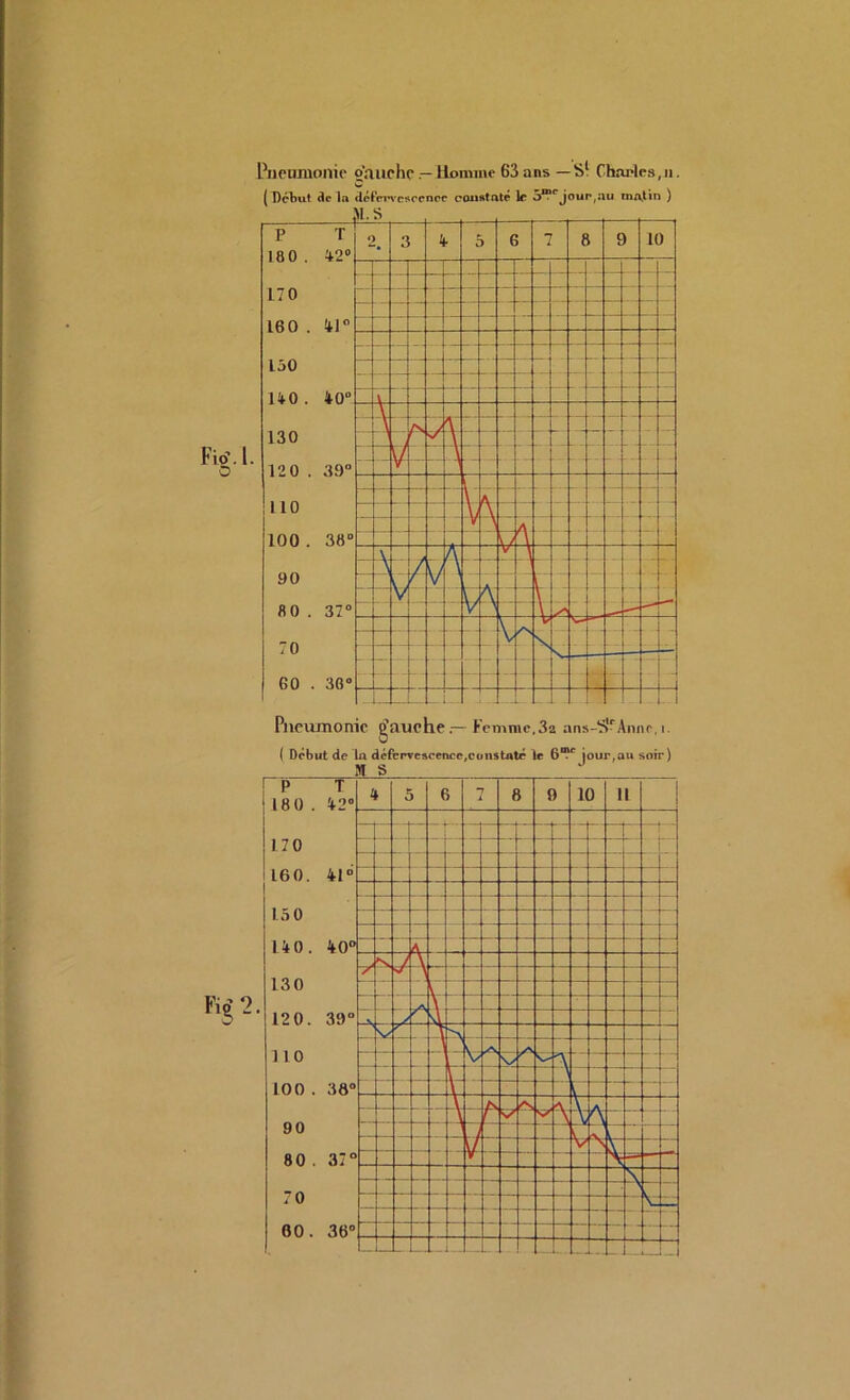 Fio’.l Pneumonie o’anehe— Homme 63 ans — S1 Charles,ii. ( Début etc la défervescence constaté le 5™pjoun,au matin ) P T 100. 42° _ 170 160 . 41° - -J 130 J O O O \ T 130 \ /s L> a _ . - \ 1 V \ 12 0 . 3.9° V 1 i. 110 \ A v \ V J A 100. 30° \ A V 90 \ / \ ( V l V A \ 80 . 37° 70 G0 . 30° V h \ \. S\ \ /s V V k- -  2. Pneumonie g'auehe — Femme.3a ans-S1'Anne, i. ( Début de la défervescence,constaté te 6®c jour,au soir) P T 180 . 42° 4 5 6 “7 8 9 10 II “T. ... 170 L60. 41“ ! 1.50 140. 40° 130 120. 39° 110 ' - - 100 . 38° . A y \ 90 80 . 37° 70 60. 36° \ % — — _ Li- L [ _.