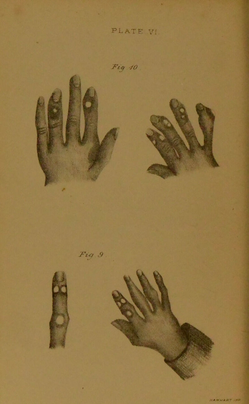 Fvy J? WAfi/HAB- .fP