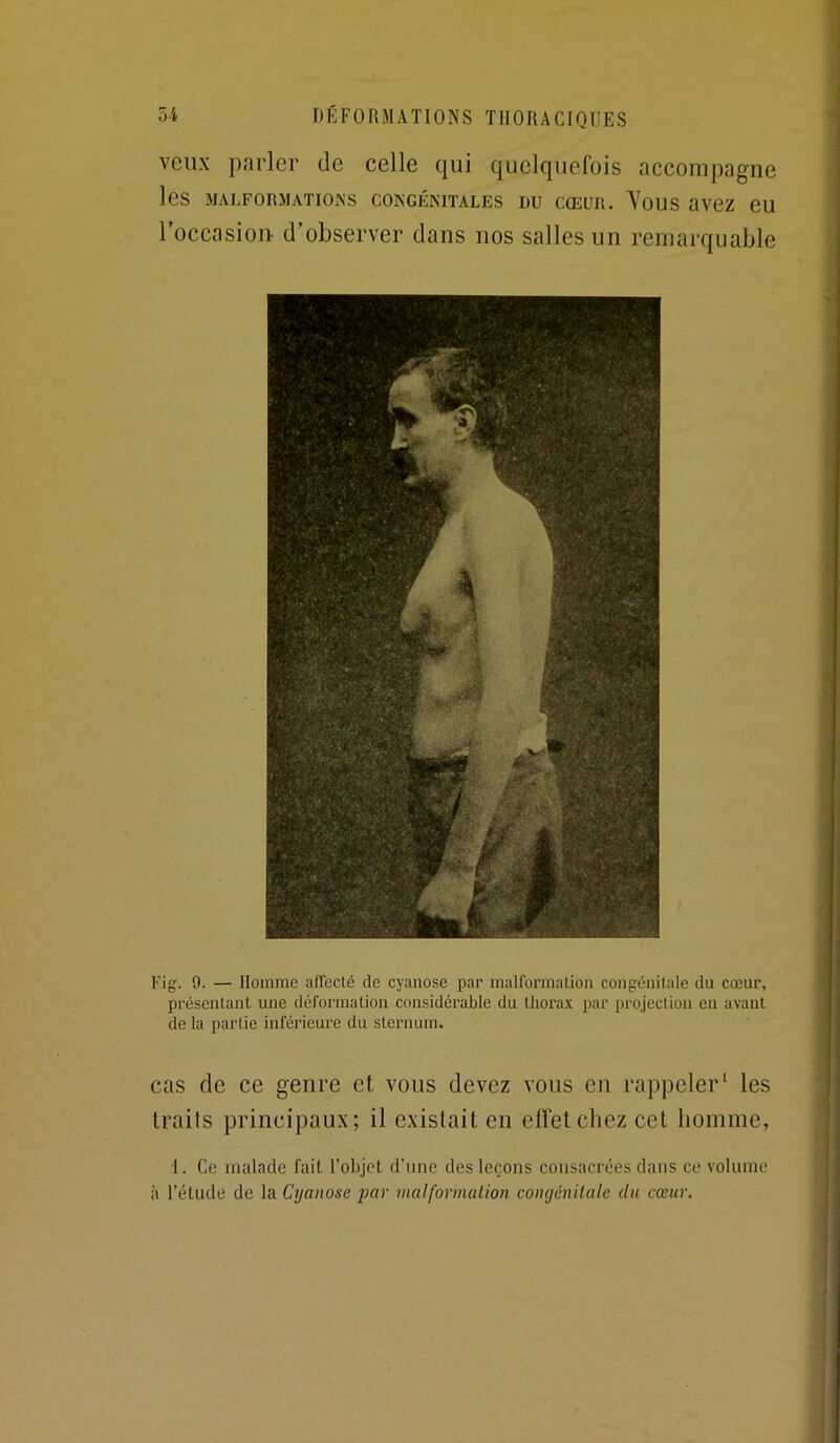 veux parler de celle qui quelquefois accompagne les MALFORMATIONS CONGÉNITALES DU CŒUR. YOUS avez eU roccasioii d’observer dans nos salles un remarquable Fig. 0. — Homme aireclé de cyanose par malformalion congénitale du cœur, présentant une déformation considérable du thora.x par projection en avant de la partie inférieure du sternum. cas de ce genre et vous devez vous en rappeler ‘ les traits principaux; il existait en elfetcliez cet homme, 1. Ce malade fait l’objet d’une des leçons cotisacrées datis ce volume à l’étude de la Cyanose par malformalion congcnilale du cœur.