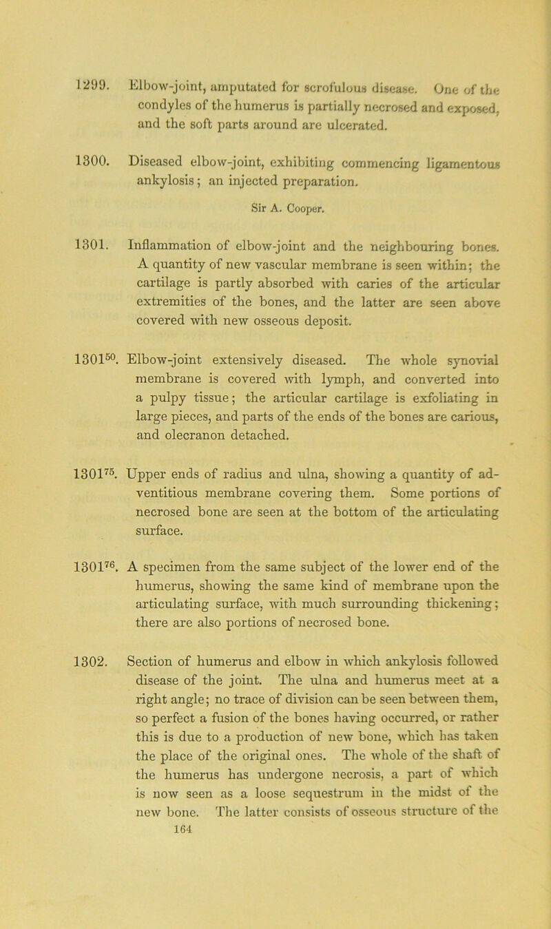 121)9. 1300. 1301. 130150. 130175. 130176. 1302. Elbow-joint, amputated for scrofulous disease. One of the condyles of the humerus is partially necrosed and exposed, and the soft parts around are ulcerated. Diseased elbow-joint, exhibiting commencing ligamentous ankylosis; an injected preparation. Sir A. Cooper. Inflammation of elbow-joint and the neighbouring bones. A quantity of new vascular membrane is seen within; the cartilage is partly absorbed with caries of the articular extremities of the bones, and the latter are seen above covered with new osseous deposit. Elbow-joint extensively diseased. The whole synovial membrane is covered with lymph, and converted into a pulpy tissue; the articular cartilage is exfoliating in large pieces, and parts of the ends of the bones are carious, and olecranon detached. Upper ends of radius and ulna, showing a quantity of ad- ventitious membrane covering them. Some portions of necrosed bone are seen at the bottom of the articulating surface. A specimen from the same subject of the lower end of the humerus, showing the same kind of membrane upon the articulating surface, with much surrounding thickening; there are also portions of necrosed bone. Section of humerus and elbow in which ankylosis followed disease of the joint. The ulna and humerus meet at a right angle; no trace of division can be seen between them, so perfect a fusion of the bones having occurred, or rather this is due to a production of new bone, which has taken the place of the original ones. The whole of the shaft of the humerus has undergone necrosis, a part of which is now seen as a loose sequestrum in the midst of the new bone. The latter consists of osseous structure of the 1G4