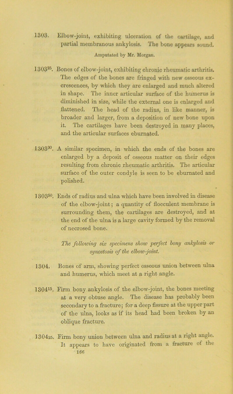 1303. Elbow-joint, exhibiting ulceration of the cartilage, and partial membranous ankylosis. The bone appears sound. Amputated by Mr. Morgan. 130325. Bones of elbow-joint, exhibiting chronic rheumatic arthritis. The edges of the bones are fringed with new osseous ex- crescences, by which they are enlarged and much altered in shape. The inner articular surface of the humerus is diminished in size, while the external one is enlarged and flattened. The head of the radius, in like manner, is broader and larger, from a deposition of new bone upon it. The cartilages have been destroyed in many places, and the articular surfaces eburnated. 130330. A similar specimen, in which the ends of the bones are enlarged by a deposit of osseous matter on their edges resulting from chronic rheumatic arthritis. The articular surface of the outer condyle is seen to be eburnated and polished. ] 30350. Ends of radius and ulna which have been involved in disease of the elbow-joint; a quantity of flocculent membrane is surrounding them, the cartilages are destroyed, and at the end of the ulna is a large cavity formed by the removal of necrosed bone. The following six specimens show perfect bong ankylosis or synostosis of the elbow-joint. 1304. Bones of arm, showing perfect osseous union between ulna and humerus, which meet at a right angle. 130415. Firm bony ankylosis of the elbow-joint, the bones meeting at a very obtuse angle. The disease has probably been secondary to a fracture; for a deep fissure at the upper part of the ulna, looks as if its head had been broken by an oblique fracture. 130425. Firm bony union between ulna and radius at a right angle. It appears to have originated from a fracture of the