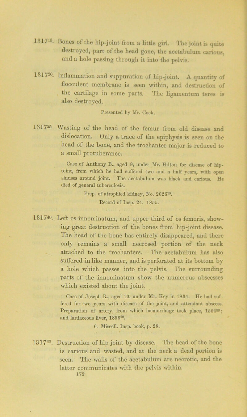 Kil?15. Hones of the hip-joint from a little girl. The joint is quite destroyed, part of the head gone, the acetabulum carious, and a hole passing through it into the pelvis. 1317'20. Inflammation and suppuration of hip-joint. A quantity of flocculent membrane is seen within, and destruction of the cartilage in some parts. The ligarnentum teres is also destroyed. Presented by Mr. Cock. 131725 Wasting of the head of the femur from old disease and dislocation. Only a trace of the epiphysis i3 seen on the head of the bone, and the trochanter major is reduced to a small protuberance. Case of Anthony B., aged 8, under Mr. Hilton for disease of hip- toint, from which he had suffered two and a half years, with open sinuses around joint. The acetabulum was black and carious. He died of general tuberculosis. Prep, of atrophied kidney, No. 202620. Eecord of Insp. 24. 1855. 131740. Left eg innominatum, and upper third of os femoris, show- ing great destruction of the bones from hip-joint disease. The head of the bone has entirely disappeared, and there only remains a small necrosed portion of the neck attached to the trochanters. The acetabulum has also suffered in like manner, and is perforated at its bottom by a hole which passes into the pelvis. The surrounding parts of the innominatum show the numerous abscesses which existed about the joint. Case of Joseph K., aged 10, under Mr. Key in 1834. He had suf- fered for two years with disease of the joint, and attendant abscess. Preparation of artery, from which haemorrhage took place, 1504s0: and lardaceous liver, 189620. 6. Miscell. Insp. book, p. 28. 131760. Destruction of hip-joint by disease. The head of the bone is carious and wasted, and at the neck a dead portion is seen. The walls of the acetabulum are necrotic, and the latter communicates with the pelvis within.