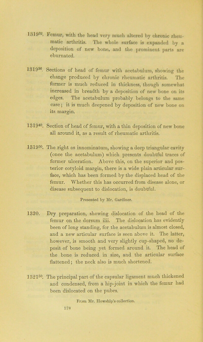 13193-. Femur, with the head very much altered by chronic rheu- matic arthritis. The whole surface is expanded by a deposition of new bone, and the prominent parts are eburnated. 131936. Sections of head of femur with acetabulum, showing the change produced by chronic rheumatic arthritis. The former is much reduced in thickness, though somewhat increased in breadth by a deposition of new bone on its edges. The acetabulum probably belongs to the same case; it is much deepened by deposition of new bone on its margin. 131940. Section of head of femur, with a thin deposition of newT bone all around it, as a result of rheumatic arthritis. 131950. The right os innominatum, showing a deep triangular cavity (once the acetabulum) which presents doubtful traces of former ulceration. Above this, on the superior and pos- terior cotyloid margin, there is a Avide plain articular sur- face, Avhich has been formed by the displaced head of the femur. Whether this has occurred from disease alone, or disease subsequent to dislocation, is doubtful. Presented by Mr. Gardiner. 1320. Dry preparation, showing dislocation of the head of the femur on the dorsum ilii. The dislocation has evidently been of long standing, for the acetabulum is almost closed, and a new articular surface is seen above it. The latter, however, is smooth and very slightly cup-shaped, no de- posit of bone being yet formed around it. The head of the bone is reduced in size, and the articular surface flattened; the neck also is much shortened. 132150. The principal part of the capsular ligament much thickened and condensed, from a hip-joint in which the femur had been dislocated on the pubes. From Mr. Ilowship’s collection.