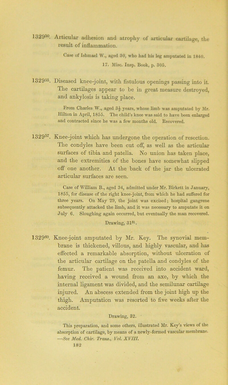 132950. Articular adhesion and atrophy of articular cartilage, the result of inflammation. Case of Ishmael W., aged 80, who had his leg amputated in 1840. 17. Misc. Insp. Book, p. 305. 132 955. Diseased knee-joint, with fistulous openings passing into it. The cartilages appear to be in great measure destroyed, and ankylosis is taking place. From Charles W., aged years, whose limb was amputated by Mr. Hilton in April, 1855. The child’s knee was said to have been enlarged and contracted since he was a few months old. Recovered. 1329°7. Knee-joint which has undergone the operation of resection. The condyles have been cut off, as well as the articular surfaces of tibia and patella. No union has taken place, and the extremities of the bones have somewhat slipped off one another. At the back of the jar the ulcerated articular surfaces are seen. Case of William B., aged 34, admitted under Mr. Birkett in January, 1855, for disease of the right knee-joint, from which he had suffered for three years. On May 29, the joint was excised; hospital gangrene subsequently attacked the limb, and it was necessary to amputate it on July 6. Sloughing again occurred, but eventually the man recovered. Drawing, 3181. 132960. Knee-joint amputated by Air. Key. The synovial mem- brane is thickened, villous, and highly vascular, and has effected a remarkable absorption, without ulceration of the articular cartilage on the patella and condyles of the femur. The patient was received into accident ward, having received a wound from an axe, by which the internal ligament was divided, and the semilunar cartilage injured. Am abscess extended from the joint high up the thigh. Amputation was resorted to five weeks after the accident. Drawing, 32. ' This preparation, and some others, illustrated Mr. Key’s views of the absorption of cartilage, by means of a newly-formed vascular membrane. —See Med. Chir. Trans., VoL XVIII.