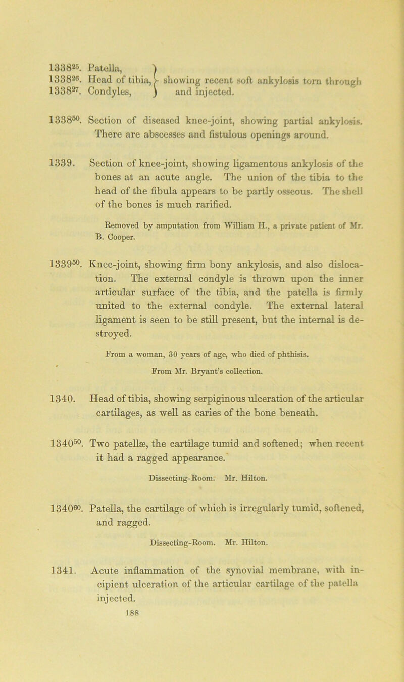 133825. Patella, ) 133820. Head of tibia, >• showing recent soft ankylosis torn through 133827. Condyles, ) and injected. 133860. Section of diseased knee-joint, showing partial ankylosis. There are abscesses and fistulous openings around. 1339. Section of knee-joint, showing ligamentous ankylosis of the bones at an acute angle. The union of the tibia to the head of the fibula appears to be partly osseous. The shell of the bones is much rarified. Removed by amputation from William H., a private patient of Mr. B. Cooper. 133950. Knee-joint, showing firm bony ankylosis, and also disloca- tion. The external condyle is thrown upon the inner articular surface of the tibia, and the patella is firmly united to the external condyle. The external lateral ligament is seen to be still present, but the internal is de- stroyed. From a woman, 30 years of age, who died of phthisis. From Mr. Bryant’s collection. 1340. Head of tibia, showing serpiginous ulceration of the articular cartilages, as well as caries of the bone beneath. 134050. Two patellae, the cartilage tumid and softened; when recent it had a ragged appearance. Dissecting-Room. Mr. Hilton. 134060. Patella, the cartilage of which is irregularly tumid, softened, and ragged. Dissecting-Room. Mr. Hilton. 1341. Acute inflammation of the synovial membrane, with in- cipient ulceration of the articular cartilage of the patella injected.