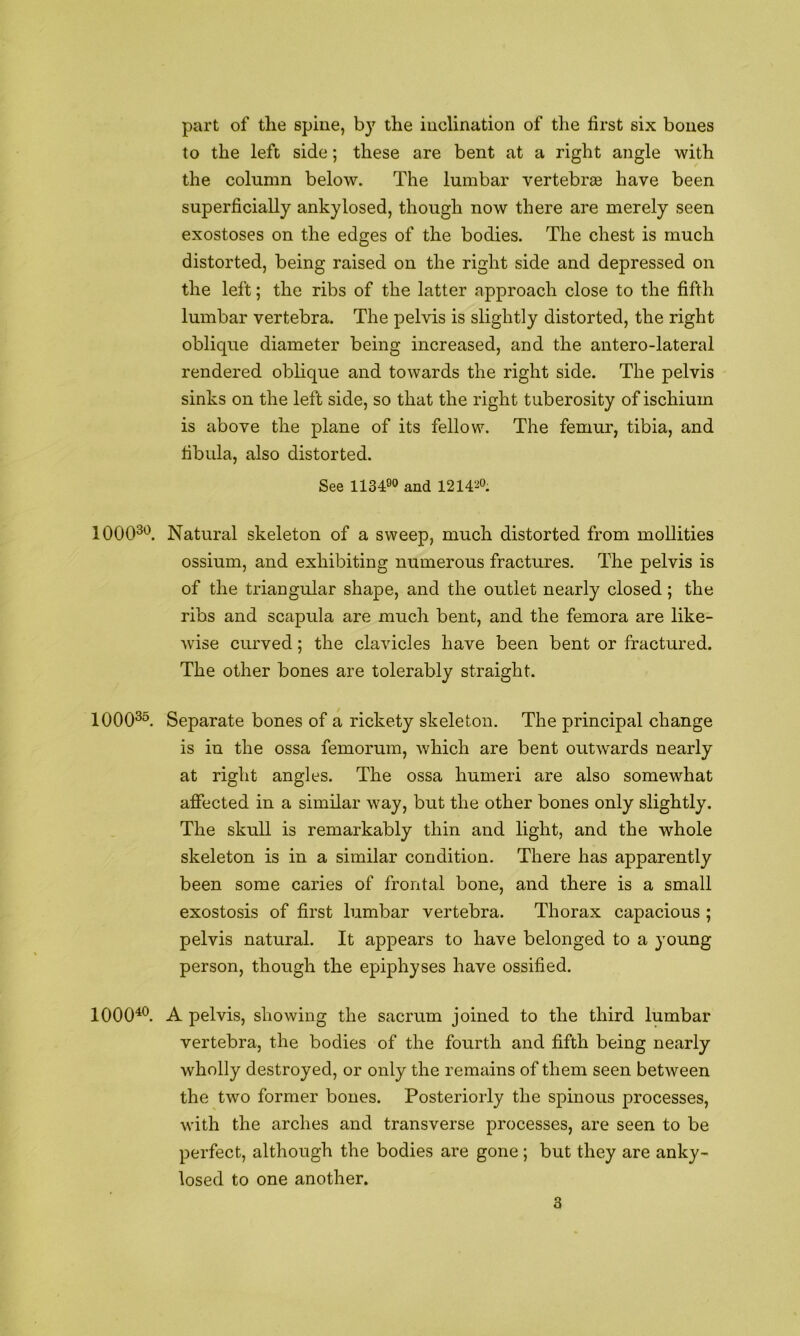part of the spiue, by the iuclination of the first six bones to the left side; these are bent at a right angle with the column below. The lumbar vertebr£e have been superficially ankylosed, though now there are merely seen exostoses on the edges of the bodies. The chest is much distorted, being raised on the right side and depressed on the left; the ribs of the latter approach close to the fifth lumbar vertebra. The pelvis is slightly distorted, the right oblique diameter being increased, and the antero-lateral rendered oblique and towards the right side. The pelvis sinks on the left side, so that the right tuberosity of ischium is above the plane of its fellow. The femur, tibia, and fibula, also distorted. See 113490 and 1214^°. 1000^'^. Natural skeleton of a sweep, much distorted from moUities ossium, and exhibiting numerous fractures. The pelvis is of the triangular shape, and the outlet nearly closed; the ribs and scapula are much bent, and the femora are like- Avise curved; the clavicles have been bent or fractured. The other bones are tolerably straight. 1000^^. Separate bones of a rickety skeleton. The principal change is in the ossa femorum, which are bent outAvards nearly at right angles. The ossa humeri are also somewhat affected in a similar way, but the other bones only slightly. The skull is remarkably thin and light, and the whole skeleton is in a similar condition. There has apparently been some caries of frontal bone, and there is a small exostosis of first lumbar vertebra. Thorax capacious ; pelvis natural. It appears to have belonged to a young person, though the epiphyses have ossified. 1000^®. A pelvis, showing the sacrum joined to the third lumbar vertebra, the bodies of the fourth and fifth being nearly wholly destroyed, or only the remains of them seen betAveen the two former bones. Posteriorly the spinous processes, Avith the arches and transverse processes, are seen to be perfect, although the bodies are gone ; but they are anky- losed to one another.