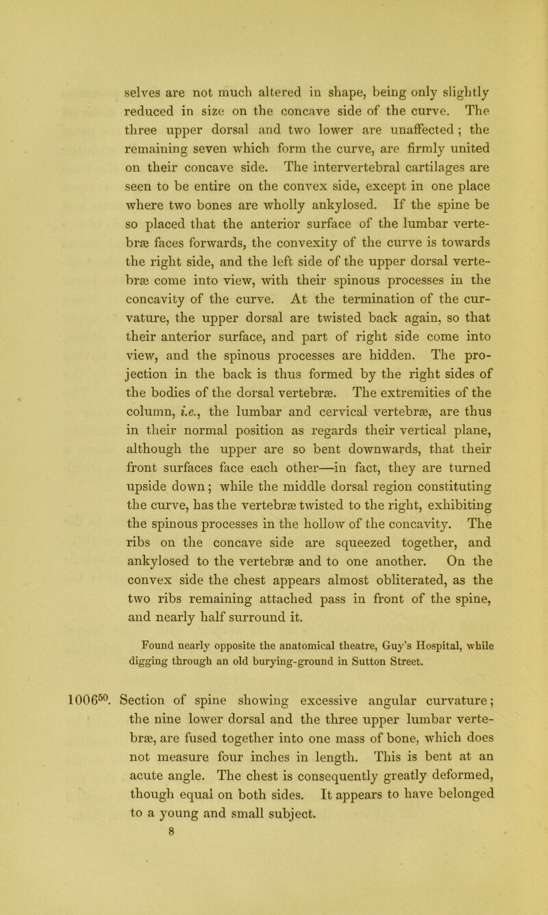 selves are not much altered in shape, being only slightly reduced in size on the concave side of the curve. The three upper dorsal and two lower are unaffected ; the remaining seven which form the curve, are firmly united on their concave side. The intervertebral cartilages are seen to be entire on the convex side, except in one place where two bones are wholly ankylosed. If the spine be so placed that the anterior surface of the lumbar verte- bras faces forwards, the convexity of the curve is towards the right side, and the left side of the upper dorsal verte- brae come into view, with their spinous processes in the concavity of the curve. At the termination of the cur- vature, the upper dorsal are twisted back again, so that their anterior surface, and part of right side come into view, and the spinous processes are hidden. The pro- jection in the back is thus formed by the right sides of the bodies of the dorsal vertebra. The extremities of the column, e.e., the lumbar and cervical vertebrae, are thus in their normal position as regards their vertical plane, although the upper are so bent downwards, that their front surfaces face each other—in fact, they are turned upside down; while the middle dorsal region constituting the curve, has the vertebra twisted to the right, exhibiting the spinous processes in the hollow of the concavity. The ribs on the concave side are squeezed together, and ankylosed to the vertebras and to one another. On the convex side the chest appears almost obliterated, as the two ribs remaining attached pass in front of the spine, and nearly half surround it. Found nearly opposite the anatomical theatre, Guy’s Hospital, while digging through an old burying-ground in Sutton Street. 1006^®. Section of spine showing excessive angular curvature; the nine lower dorsal and the three upper lumbar verte- brae, are fused together into one mass of bone, which does not measure four inches in length. This is bent at an acute angle. The chest is consequently greatly deformed, though equal on both sides. It appears to have belonged to a young and small subject.
