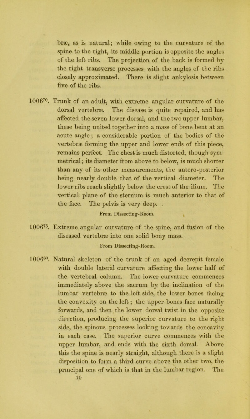 brae, as is natural; while owing to the curvature of the spine to the right, its middle portion is opposite the angles of the left ribs. The projection of the back is formed by the right transverse processes with the angles of tlie ribs closely approximated. There is slight ankylosis between five of the ribs. 1006^^. Trunk of an adult, with extreme angular curvature of the dorsal vertebrae. The disease is quite repaired, and has affected the seven lower dorsal, and the two upper lumbar, these being united together into a mass of bone bent at an acute angle; a considerable portion of the bodies of the vertebra3 forming the upper and lower ends of this piece, remains perfect. The chest is much distorted, though sym- metrical; its diameter from above to below, is much shorter than any of its other measurements, the antero-posterior being nearly double that of the vertical diameter. The lower ribs reach slightly below the crest of the ilium. The vertical plane of the sternum is much anterior to that of the face. The pelvis is very deep. , From Dissecting-Room. , 1006'^^. Extreme angular curvature of the spine, and fusion of the diseased vertebraB into one solid bony mass. From Dissecting-Room. ] 006®^^ Natural skeleton of the trunk of an aged decrepit female with double lateral curvature affecting the lower half of the vertebral column. The lower curvature commences immediately above the sacrum by the inclination of the lumbar vertebrte to the left side, the lower bones facing the convexity on the left; the upper bones face naturally forwards, and then the lower dorsal twist in the opposite direction, producing the superior curvature to the right side, the spinous processes looking towards the concavity in each case. The superior curve commences with the upper lumbar, and ends with the sixth dorsal. Above this the spine is nearly straight, although there is a slight disposition to form a third curve above the other two, the principal one of which is that in the lumbar region. The