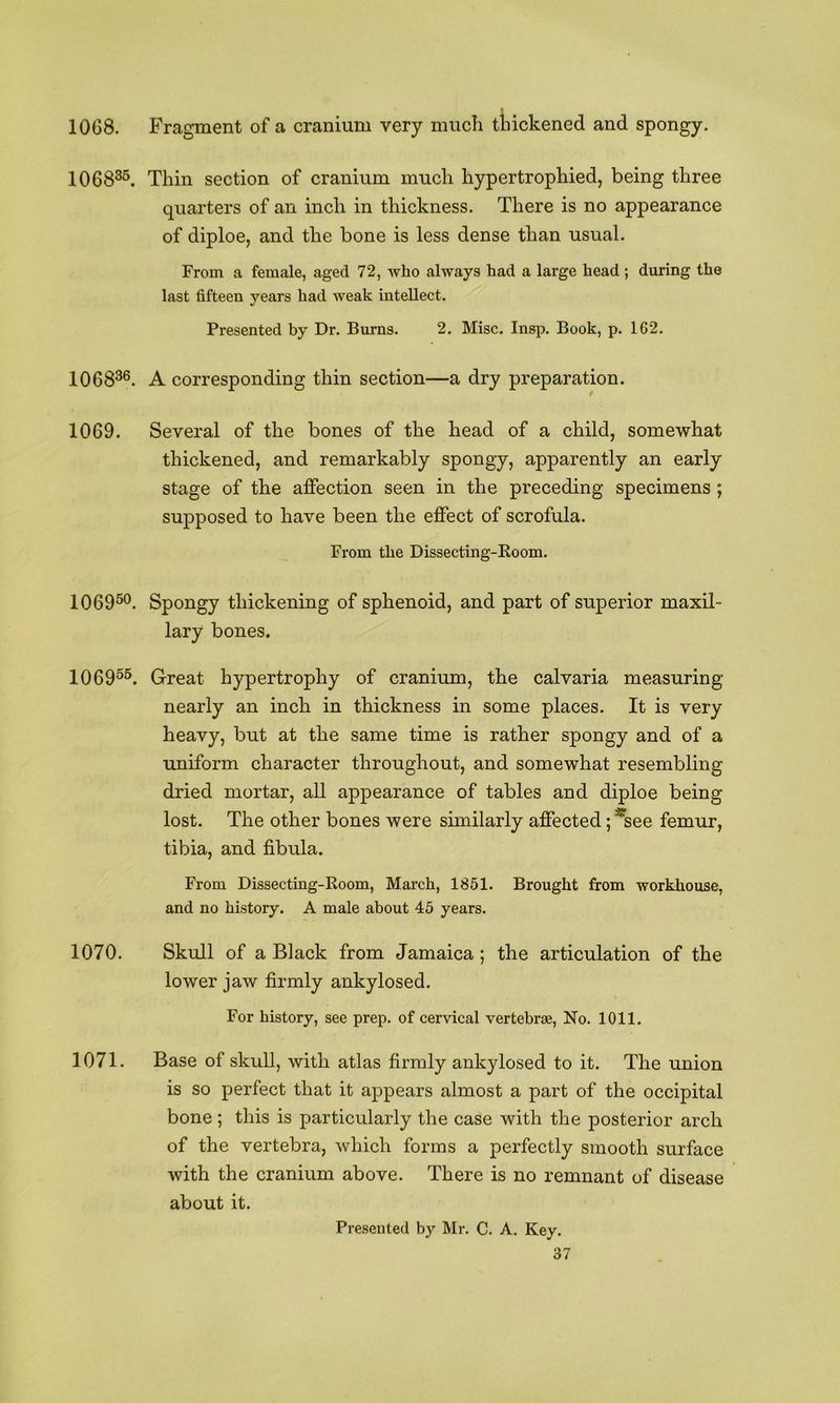 10G8. Fragment of a cranium very much thickened and spongy. 106835. 106836. 1069. 106950. 106955. 1070. 1071. Thin section of cranium much hypertrophied, being three quarters of an inch in thickness. There is no appearance of diploe, and the bone is less dense than usual. From a female, aged 72, who always had a large head ; during the last fifteen years had weak intellect. Presented by Dr. Burns. 2. Misc. Insp. Book, p. 162. A corresponding thin section—a dry preparation. Several of the bones of the head of a child, somewhat thickened, and remarkably spongy, apparently an early stage of the affection seen in the preceding specimens ; supposed to have been the effect of scrofula. From the Dissecting-Room. Spongy thickening of sphenoid, and part of superior maxil- lary bones. Great hypertrophy of cranium, the calvaria measuring nearly an inch in thickness in some places. It is very heavy, but at the same time is rather spongy and of a uniform character throughout, and somewhat resembling dried mortar, all appearance of tables and diploe being lost. The other bones were similarly affected; *see femur, tibia, and fibula. From Dissecting-Room, March, 1851. Brought from workhouse, and no history. A male about 45 years. Skull of a Black from Jamaica ; the articulation of the lower jaw firmly ankylosed. For history, see prep, of cervical vertebrae. No. 1011. Base of skull, with atlas firmly ankylosed to it. The union is so perfect that it appears almost a part of the occipital bone ; this is particularly the case with the posterior arch of the vertebra, which forms a perfectly smooth surface with the cranium above. There is no remnant of disease about it. Presented by Mr. C. A. Key.