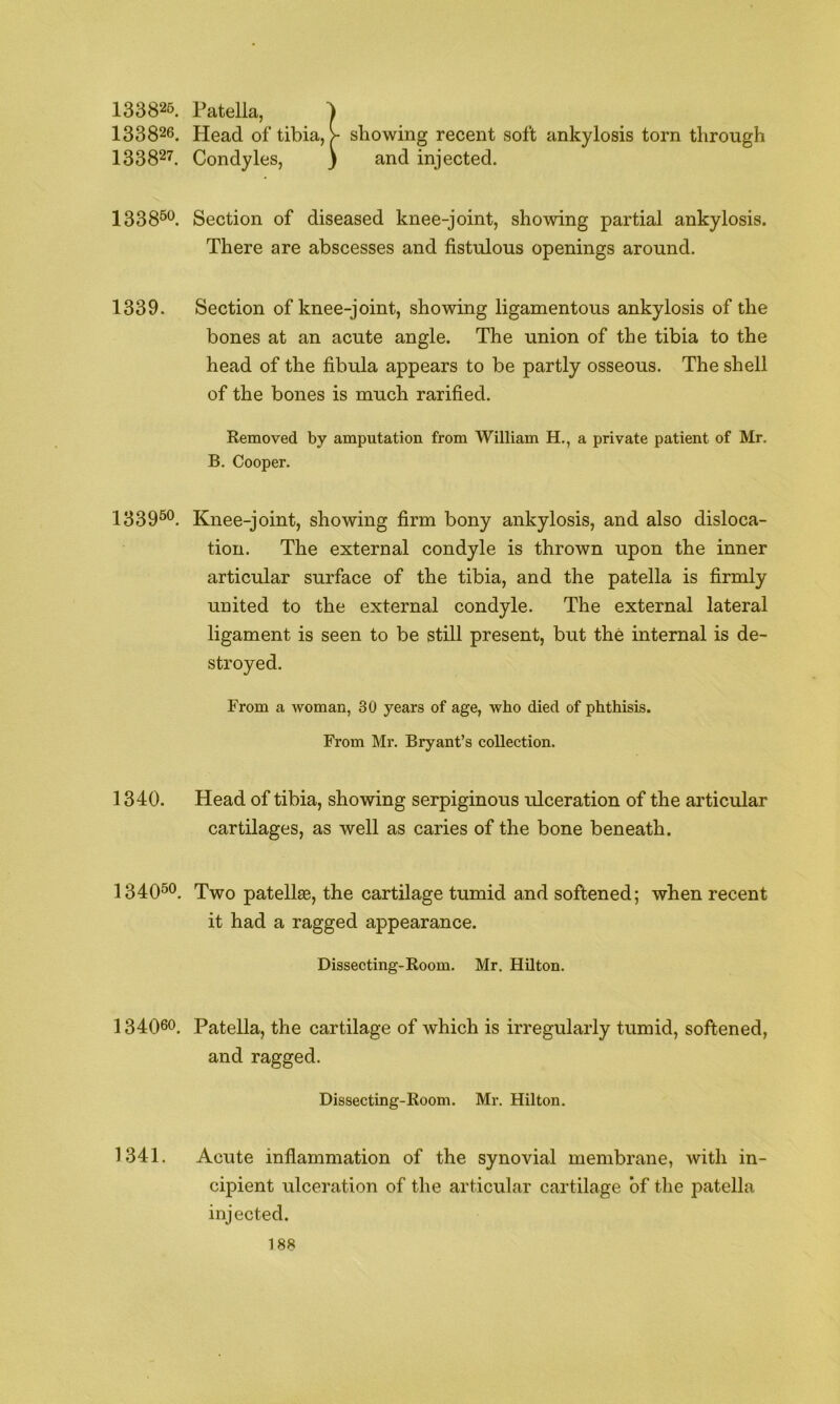 133826. Patella, 133826. Head of tibia, ^ showing recent soft ankylosis torn through 133827. Condyles, ) and injected. 1338®*^. Section of diseased knee-joint, showing partial ankylosis. There are abscesses and fistulous openings around. 1339. Section of knee-joint, showing ligamentous ankylosis of the bones at an acute angle. The union of the tibia to the head of the fibula appears to be partly osseous. The shell of the bones is much rarified. Removed by amputation from William H., a private patient of Mr. B. Cooper. 1339^*^. Knee-joint, showing firm bony ankylosis, and also disloca- tion. The external condyle is thrown upon the inner articular surface of the tibia, and the patella is firmly united to the external condyle. The external lateral ligament is seen to be still present, but the internal is de- stroyed. From a woman, 30 years of age, who died of phthisis. From Mr. Bryant’s collection. 1340. Head of tibia, showing serpiginous ulceration of the articular cartilages, as well as caries of the bone beneath. 2 34050. Xwo patellae, the cartilage tumid and softened; when recent it had a ragged appearance. Dissecting-Room. Mr. Hilton. 134060. Patella, the cartilage of which is irregularly tumid, softened, and ragged. Dissecting-Room. Mr. Hilton. 1341. Acute inflammation of the synovial membrane, with in- cipient ulceration of the articular cartilage of the patella injected.