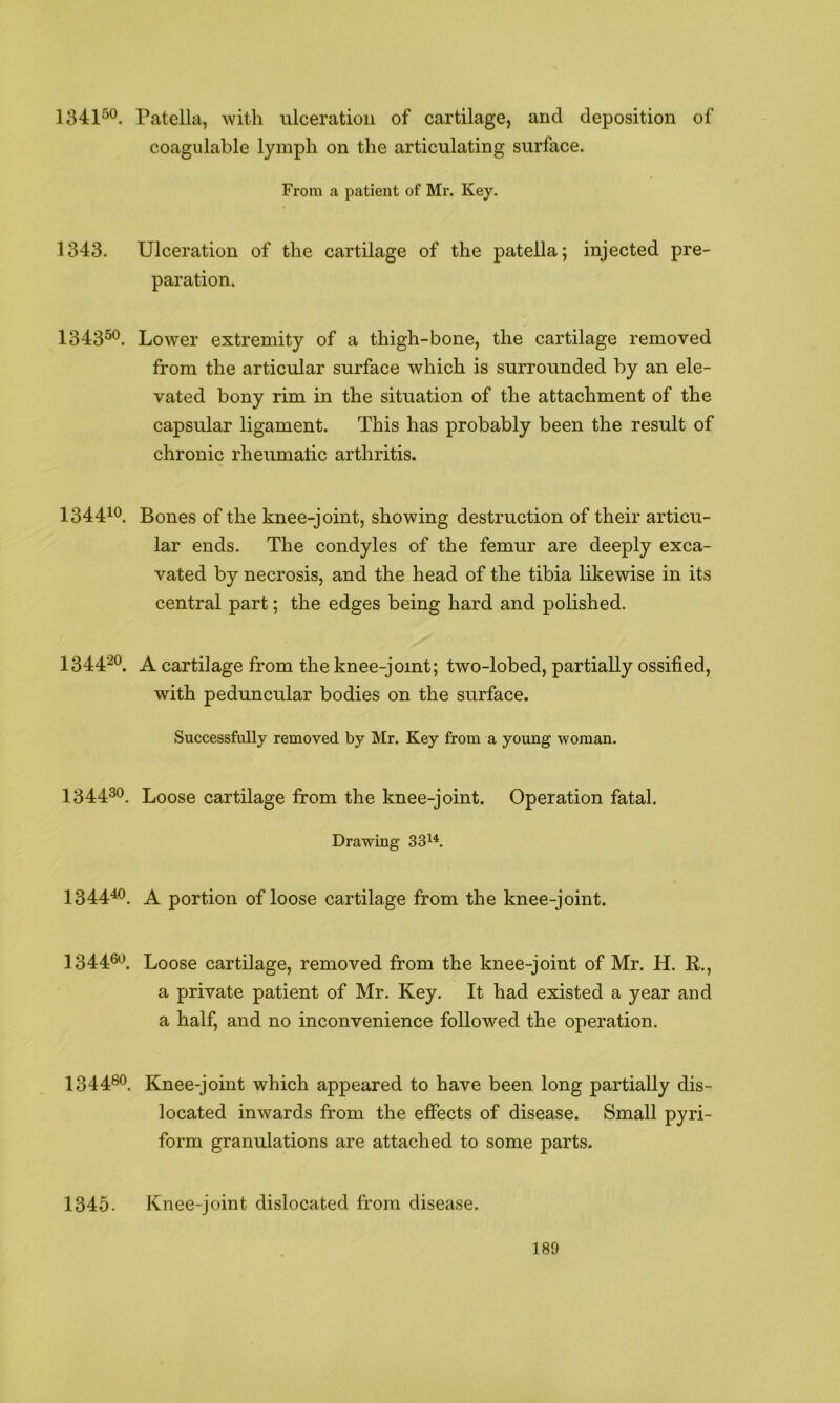 1341^*^. Patella, with ulceration of cartilage, and deposition of coagulable lymph on the articulating surface. From a patient of Mr. Key. 1343. Ulceration of the cartilage of the patella; injected pre- paration. 134350. Lower extremity of a thigh-bone, the cartilage removed from the articular surface which is surrounded by an ele- vated bony rim in the situation of the attachment of the capsular ligament. This has probably been the result of chronic rheumatic arthritis. 134410. Bones of the knee-joint, showing destruction of their articu- lar ends. The condyles of the femur are deeply exca- vated by necrosis, and the head of the tibia likewise in its central part; the edges being hard and polished. 134420^ A cartilage from the knee-joint; two-lobed, partially ossified, with peduncular bodies on the surface. Successfully removed by Mr. Key from a young woman. 134430 Loose cartilage from the knee-joint. Operation fatal. Drawing 33^^ 134440^ A portion of loose cartilage from the knee-joint. 134460^ Loose cartilage, removed from the knee-joint of Mr. H. K., a private patient of Mr. Key. It had existed a year and a half, and no inconvenience followed the operation. I3448O. Knee-joint which appeared to have been long partially dis- located inwards from the effects of disease. Small pyri- form granulations are attached to some parts. 1345. Knee-joint dislocated from disease.