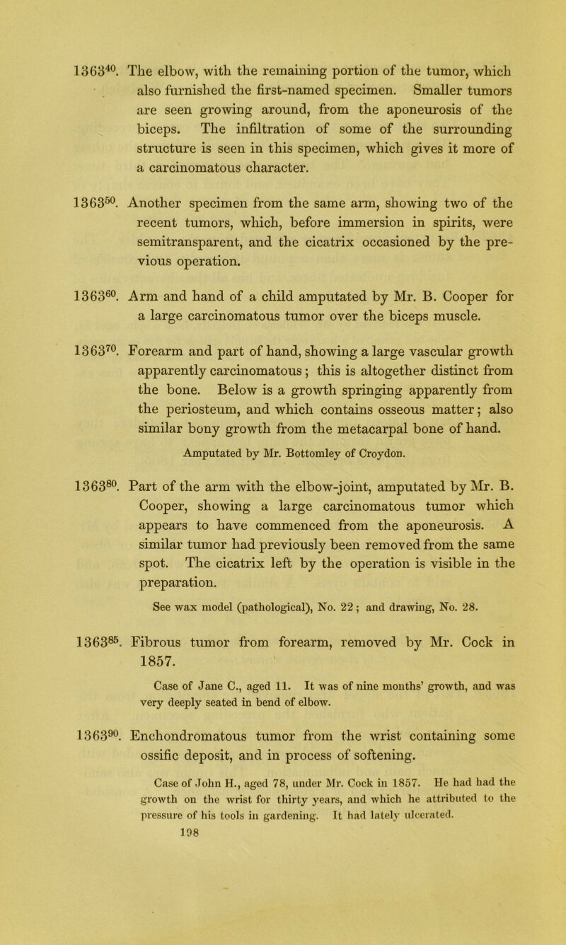 1368^^. The elbow, with the remaining portion of the tumor, which also furnished the first-named specimen. Smaller tumors are seen growing around, from the aponeurosis of the biceps. The infiltration of some of the surrounding structure is seen in this specimen, which gives it more of a carcinomatous character. 1363®*^. Another specimen from the same arm, showing two of the recent tumors, which, before immersion in spirits, were semitransparent, and the cicatrix occasioned by the pre- vious operation. 1363®*^. Arm and hand of a child amputated by Mr. B. Cooper for a large carcinomatous tumor over the biceps muscle. 1363^®. Forearm and part of hand, showing a large vascular growth apparently carcinomatous; this is altogether distinct from the bone. Below is a growth springing apparently from the periosteum, and which contains osseous matter; also similar bony growth from the metacarpal bone of hand. Amputated by Mr. Bottomley of Croydon. 1363®^. Part of the arm with the elbow-joint, amputated by Mr. B. Cooper, showing a large carcinomatous tumor which appears to have commenced from the aponeurosis. A similar tumor had previously been removed from the same spot. The cicatrix left by the operation is visible in the preparation. See wax model (pathological), No. 22; and drawing, No. 28. 1363®®. Fibrous tumor from forearm, removed by Mr. Cock in 1857. Case of Jane C., aged 11. It was of nine months’ growth, and was very deeply seated in bend of elbow. 13 63®*^. Enchondromatous tumor from the wrist containing some ossific deposit, and in process of softening. Case of John H., aged 78, under Mr. Cock in 1857. He had had the growth on the wrist for thirty years, and which he attributed to the pressure of his tools in gardening. It had lately ulcerated.