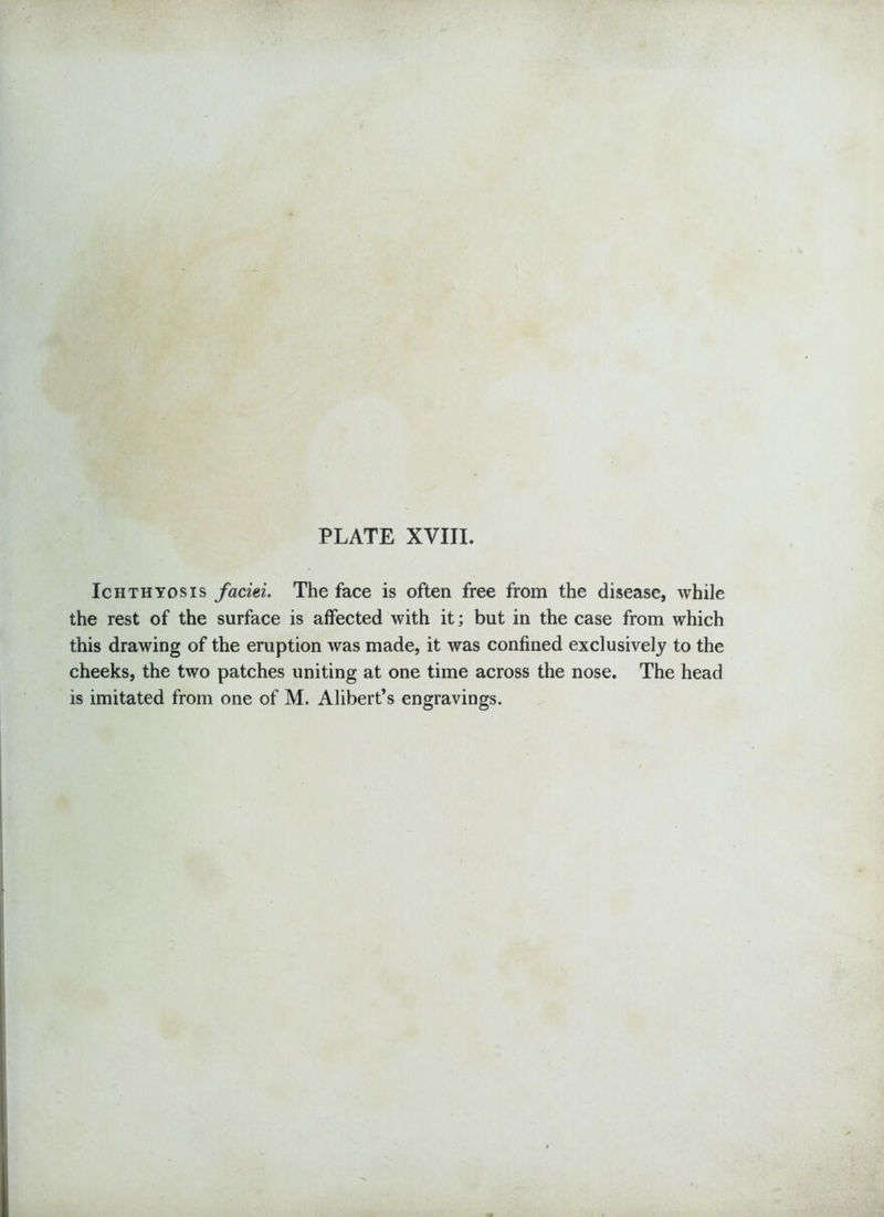 Ichthyosis faciei. The face is often free from the disease, while the rest of the surface is affected with it; but in the case from which this drawing of the eruption was made, it was confined exclusively to the cheeks, the two patches uniting at one time across the nose. The head is imitated from one of M. Alibert’s engravings.