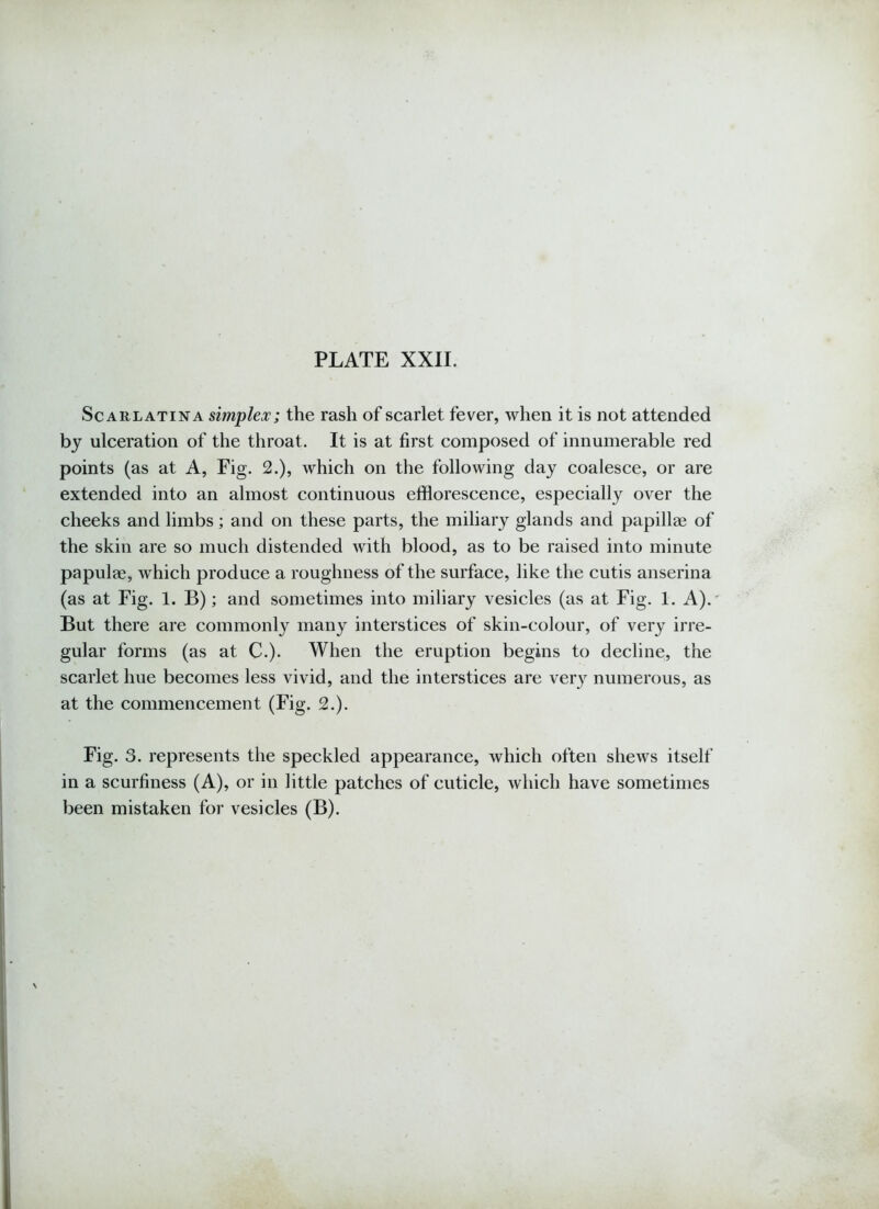 Scarlatina simplex; the rash of scarlet fever, when it is not attended by ulceration of the throat. It is at first composed of innumerable red points (as at A, Fig. 2.), which on the following day coalesce, or are extended into an almost continuous efflorescence, especially over the cheeks and limbs; and on these parts, the miliary glands and papillae of the skin are so much distended with blood, as to be raised into minute papulae, which produce a roughness of the surface, like the cutis anserina (as at Fig. 1. B); and sometimes into miliary vesicles (as at Fig. 1. A).' But there are commonly many interstices of skin-colour, of very irre- gular forms (as at C.). When the eruption begins to decline, the scarlet hue becomes less vivid, and the interstices are very numerous, as at the commencement (Fig. 2.). Fig. 3. represents the speckled appearance, which often shews itself in a scurfiness (A), or in little patches of cuticle, which have sometimes been mistaken for vesicles (B).