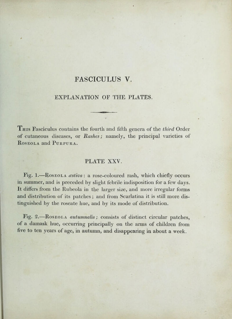 FASCICULUS Y. EXPLANATION OF THE PLATES. This Fasciculus contains the fourth and fifth genera of the third Order of cutaneous diseases, or Rashes; namely, the principal varieties of Roseola and Purpura. PLATE XXV. Fig. 1.—Roseola cesiiva: a rose-coloured rash, which chiefly occurs in summer, and is preceded by slight febrile indisposition for a few days. It differs from the Rubeola in the larger size, and more irregular forms and distribution of its patches; and from Scarlatina it is still more dis- tinguished by the roseate hue, and by its mode of distribution. Fig. 2.—Roseola autumnalis; consists of distinct circular patches, of a damask hue, occurring principally on the arms of children from five to ten years of age, in autumn, and disappearing in about a week.