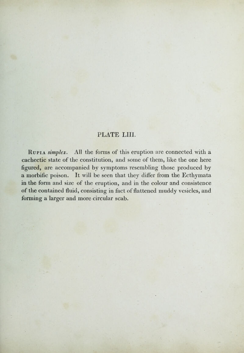 Rupia simplex. All the forms of this eruption are connected with a cachectic state of the constitution, and some of them, like the one here figured, are accompanied by symptoms resembling those produced by a morbific poison. It will be seen that they differ from the Ecthymata in the form and size of the eruption, and in the colour and consistence of the contained fluid, consisting in fact of flattened muddy vesicles, and forming a larger and more circular scab.