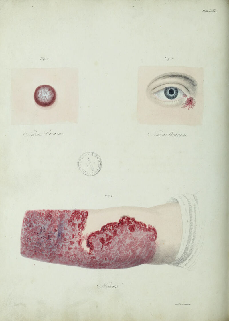 Ft a. 2. Vtr.rH.j > / VV7/.V f/.J Fig.,3. C 1 fi'ru. / ///'/</.