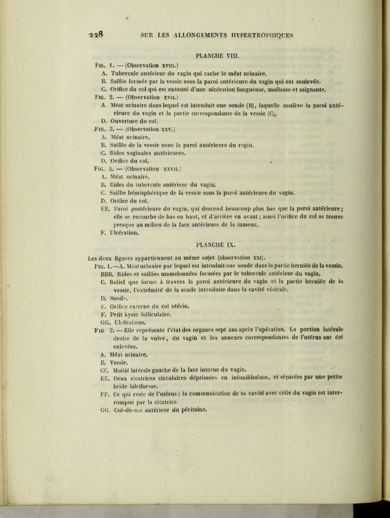 2q8 PLANCHE VIII. Fig. 1.—(Observation xvm.) A. Tubercule antérieur du vagin qui cache le méat urinaire. B. Saillie formée par la vessie sous la paroi antérieure du vagin qni est soulevée. C. Orifice du col qui est entouré d’une ulcération fongueuse, mollasse et saignante. Fig. 2. — (Observation xvu.) A. Méat urinaire dans lequel est introduit une sonde (B), laquelle soulève la paroi anté- rieure du vagin et la partie correspondante de la vessie (C)# D. Ouverture du col. Fig. 3. — (Observation xxv.) A. Méat urinaire. B. Saillie de la vessie sous la paroi antérieure du vagin. <1. Rides vaginales antérieures. D. Orifice du col. « Fig. k. — (Observation xxvii.) A. Méat urinaire. B. Rides du tubercule antérieur du vagin. C. Saillie hémisphérique de la vessie sous la paroi antérieure du vagin. D. Orifice du col. EE. Paroi postérieure du vagin, qui descend beaucoup plus bas que la paroi antérieure ; elle se recourbe de bas en haut, et d'arrière en avant ; aussi l’orifice du col se trouve presque au milieu de la face antérieure, de la tumeur. F. Ulcération. PLANCHE IX. Les deux figures appartiennent au même sirjet (observation xxi). Fig. 1.—A. Méat urinaire par lequel est introduit une sonde dans la partie herniée de la vessie. BBB. Rides et saillies mamelonnées formées par le tubercule antérieur du vagin. C. Relief que forme à travers la paroi antérieure du vagin et la partie herniée de la vessie, l’extrémité de la sonde introduite dans la cavité vésicale. D. Sonde. F. Orifice externe du col utérin. F. Petit kyste folliculaire. GG. Ulcérations. Fig. 2.—Elle représente l’état des organes sept ans après l’opération. La portion latérale droite de la vulve, du vagin et les annexes correspondantes de l’utérus ont été enlevées. A. Méat urinaire. B. Vessie. CC. Moitié latérale gauche de la face interne du vagin. EE. Deux cicatrices circulaires déprimées en infundibulum, et séparées par une petite bride falciforme. FF. Ce qui reste de l’utérus ; la communication de sa cavité avec celle du vagin est inter- rompue par la cicatrice. GG. Cul-de-sac antérieur du péritoine.