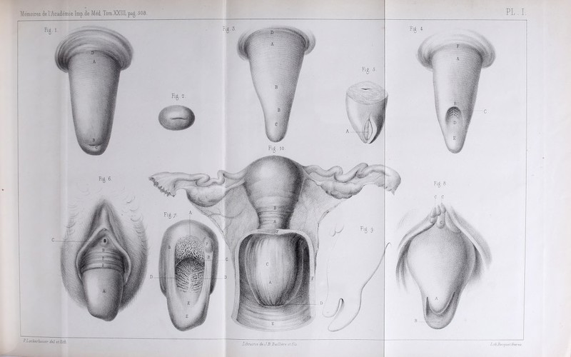 r.Lackerbauer del etlith.