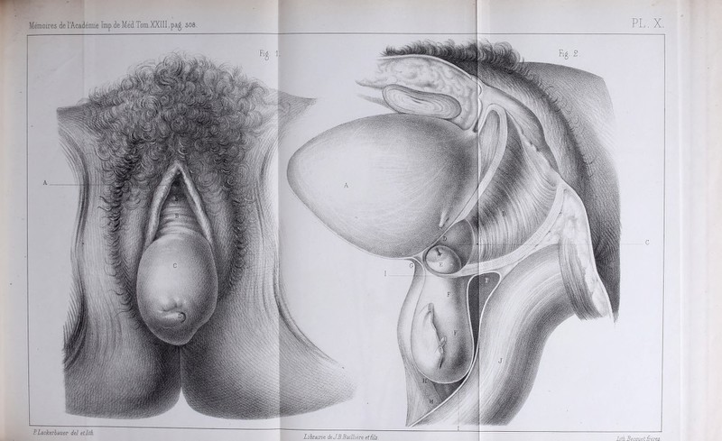 PLackerlauer iel etlith. librairie deJBBaillière etSls. PL , X. litkBecmietirères.