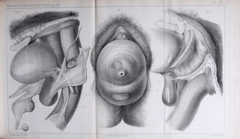 P.Lackerbauer deletlith Librairie de JBBailli'eve et fils Lith.Beccju.eL frères.